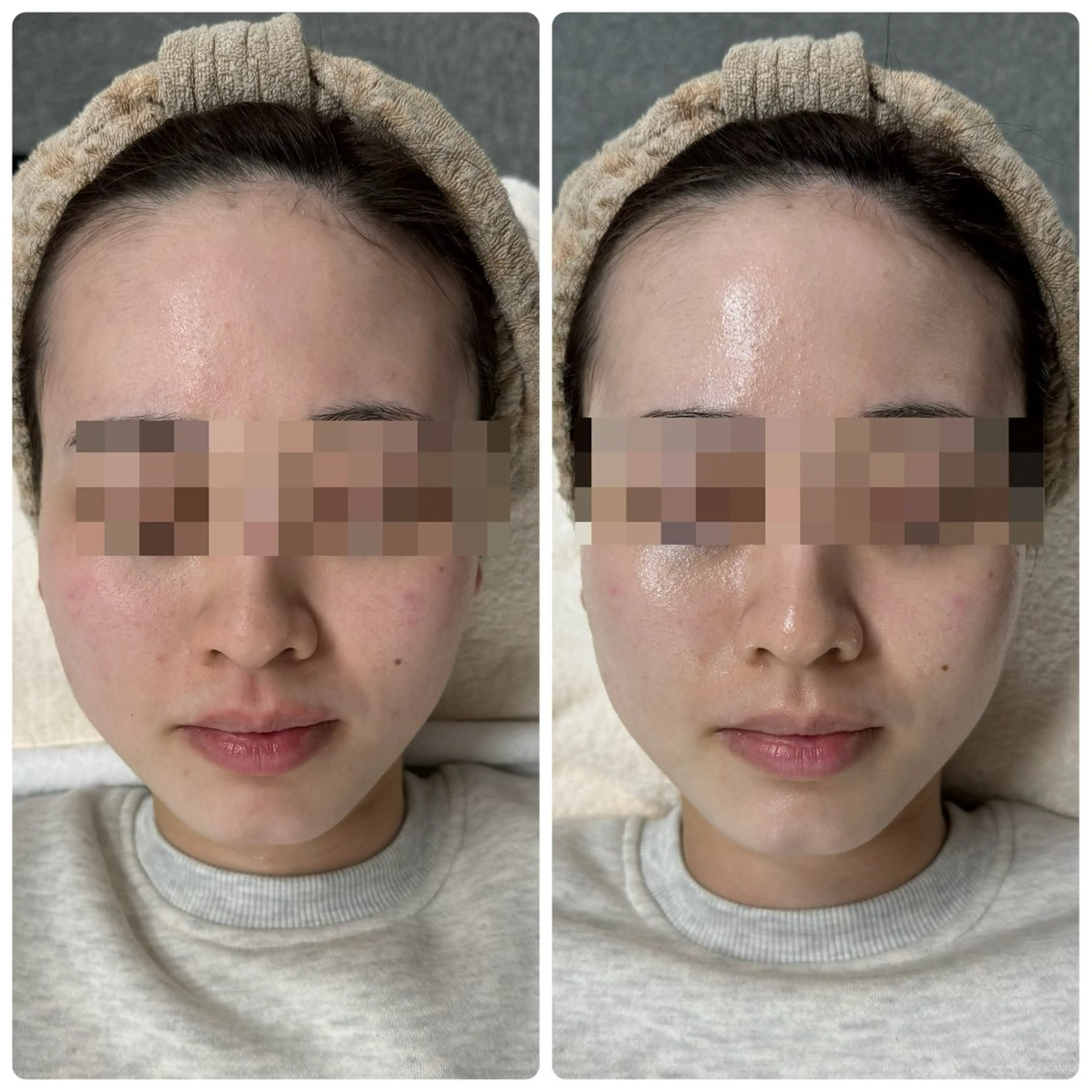 エステ 脱毛&フェイシャル 専門店muro.のエステ・リラクイメージ