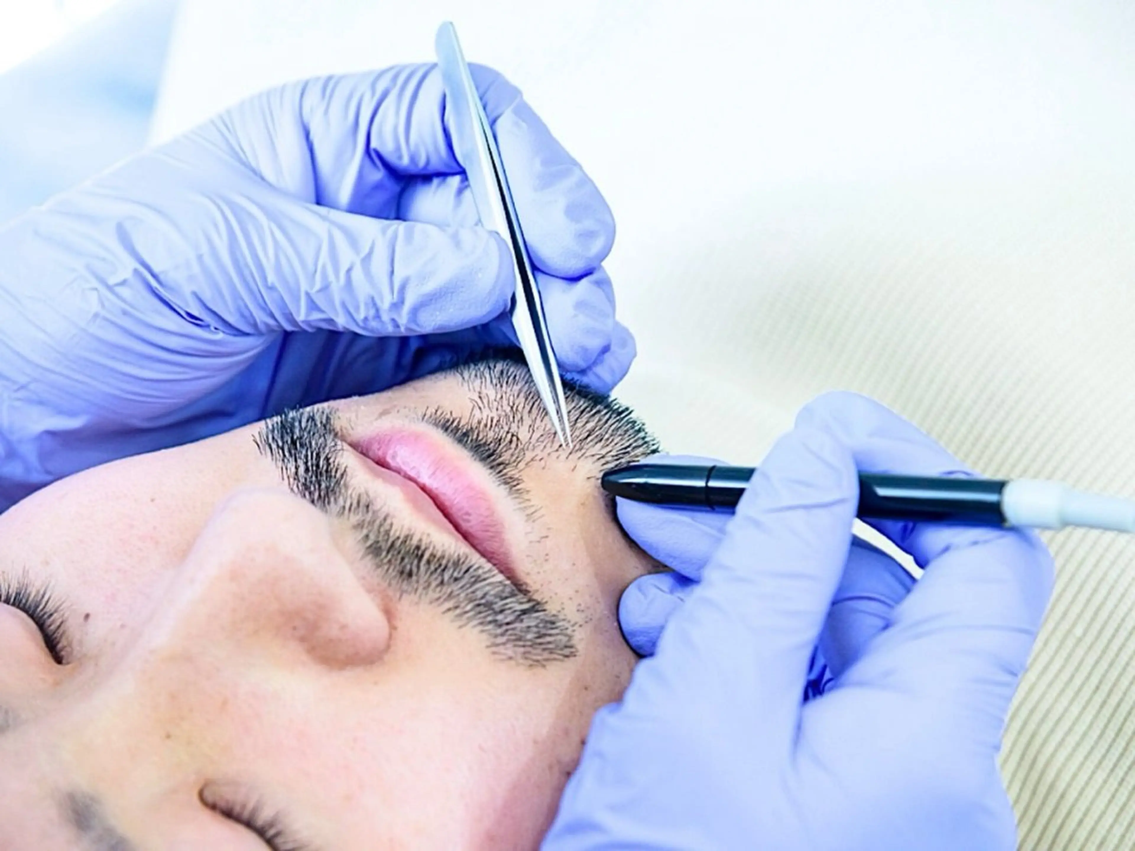 メンズ 【一本ずつ脱毛】 ReMove 柏のエステ・リラクイメージ