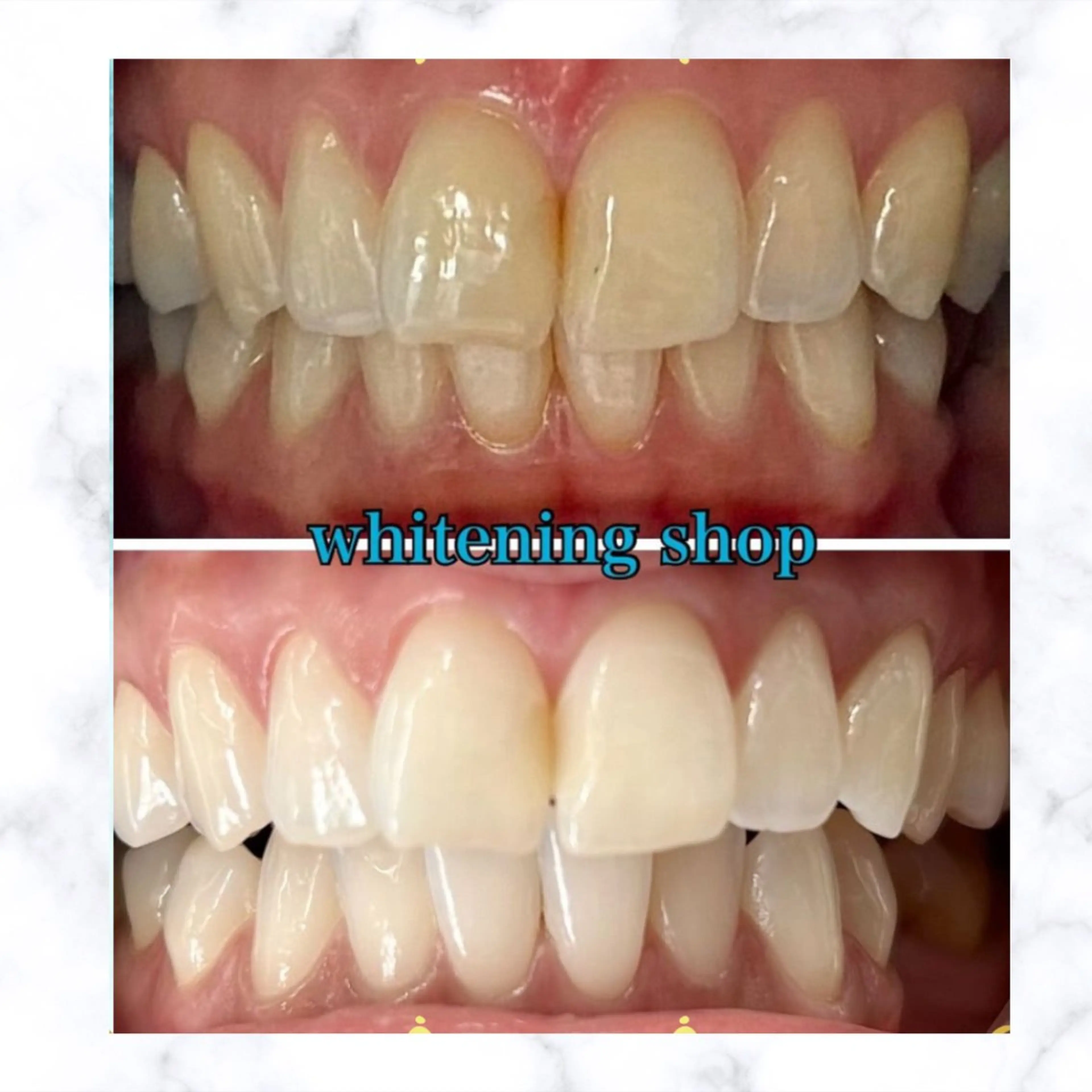 ホワイトニングショップ時津店所属・ホワイトニング ショップ長崎時津店のその他イメージ