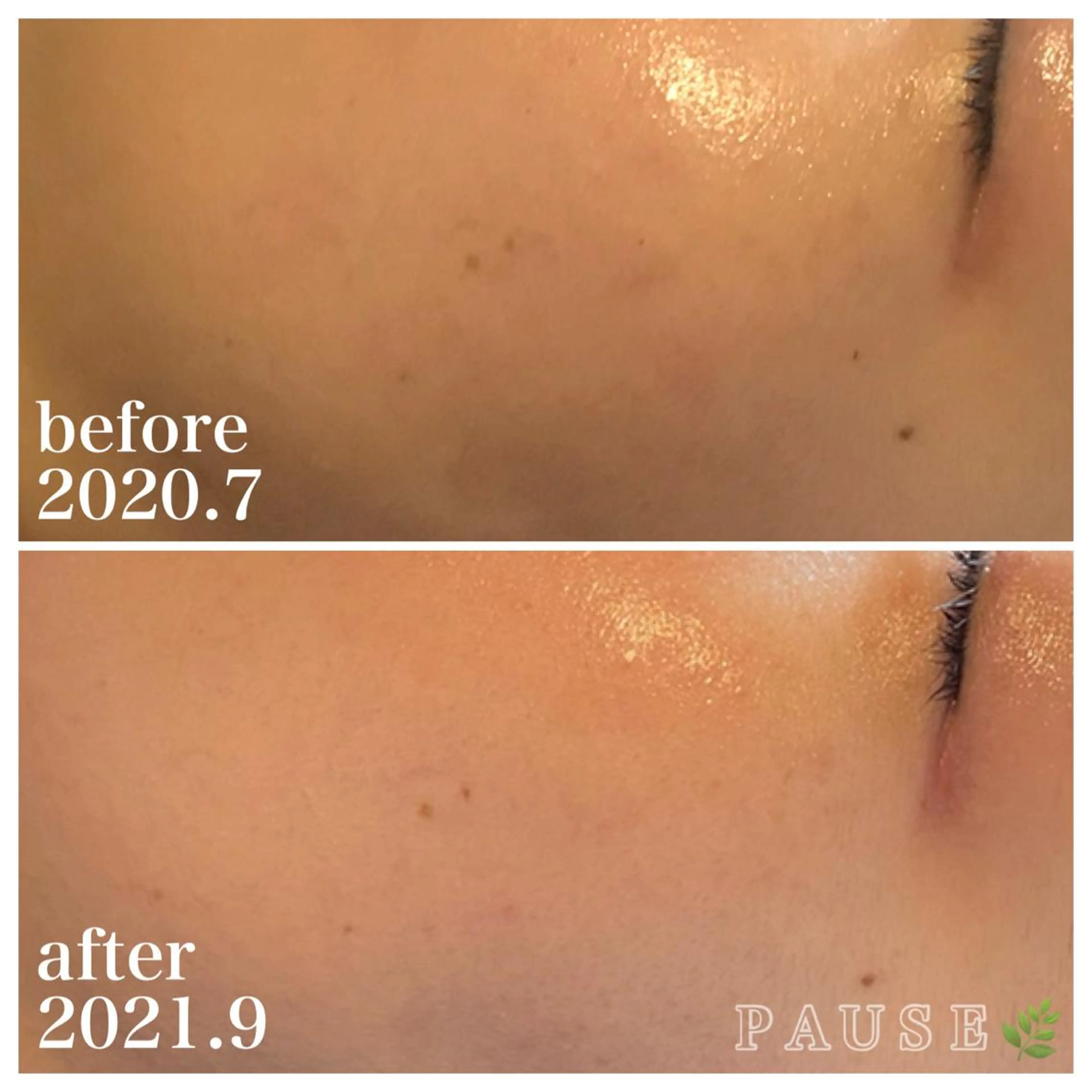 エステ 浜野 恵美のエステ・リラクイメージ