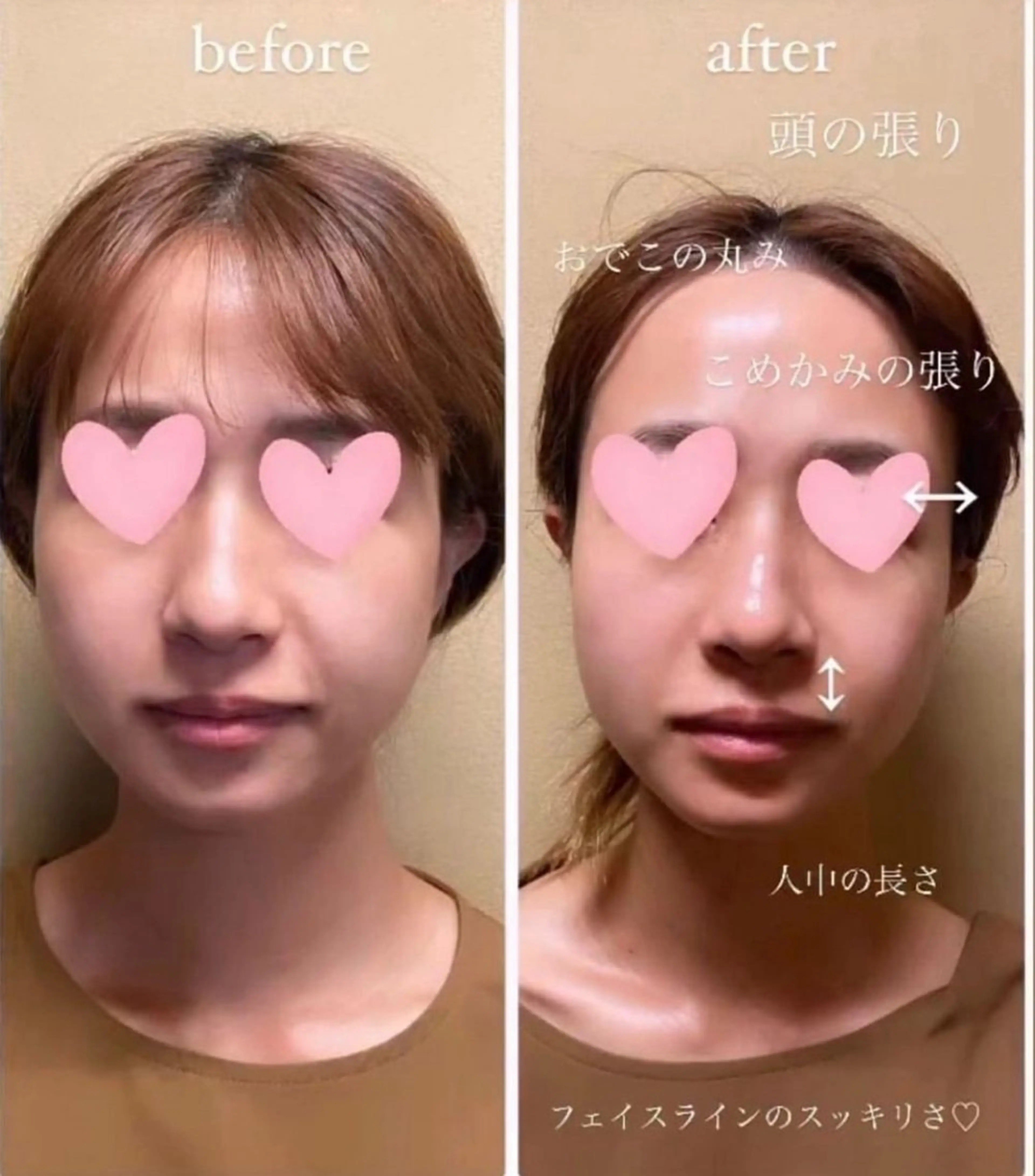 エステ リラク 自律神経を整える フェイシャルエステのエステ・リラクイメージ