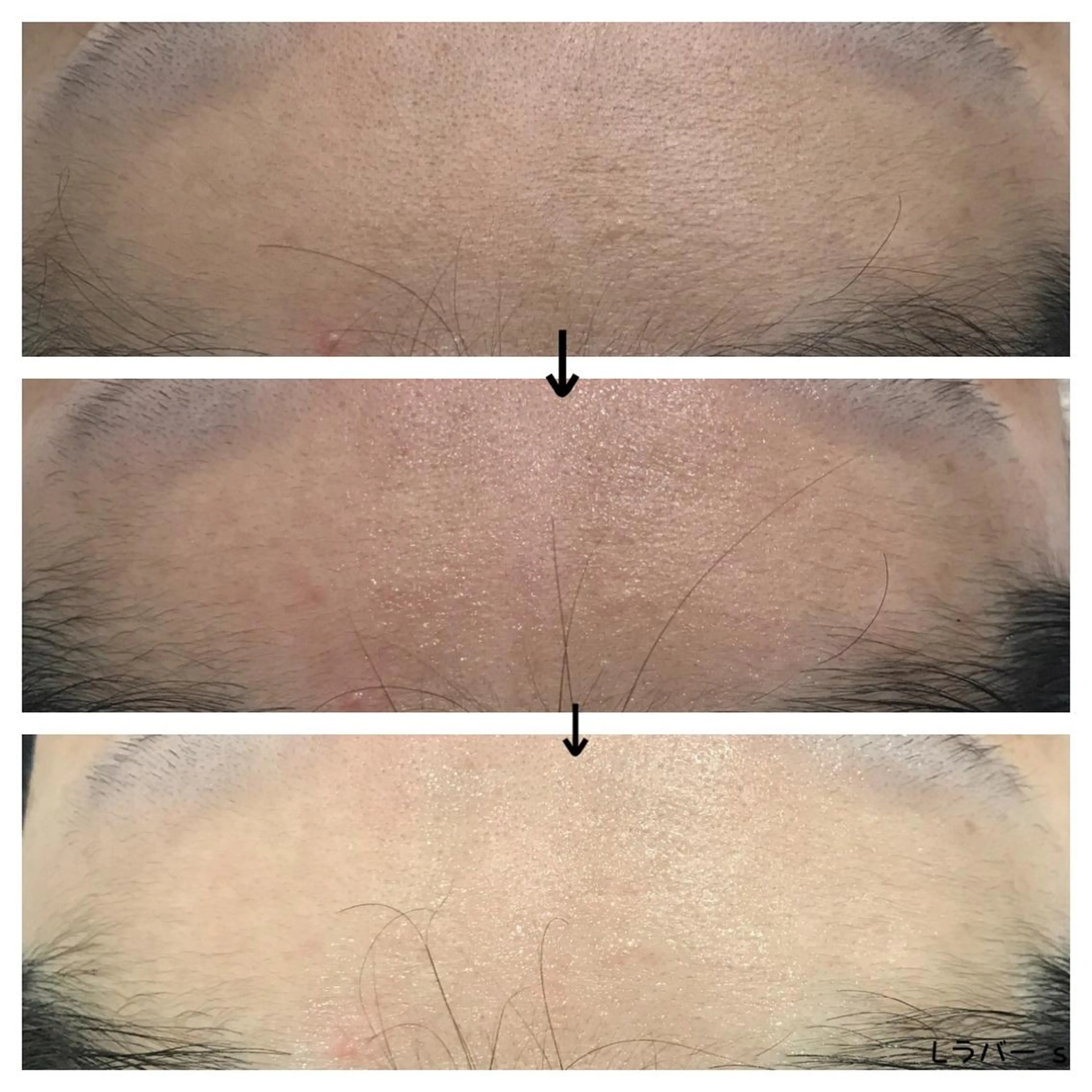 ビューティー ミロワールのエステ・リラクイメージ