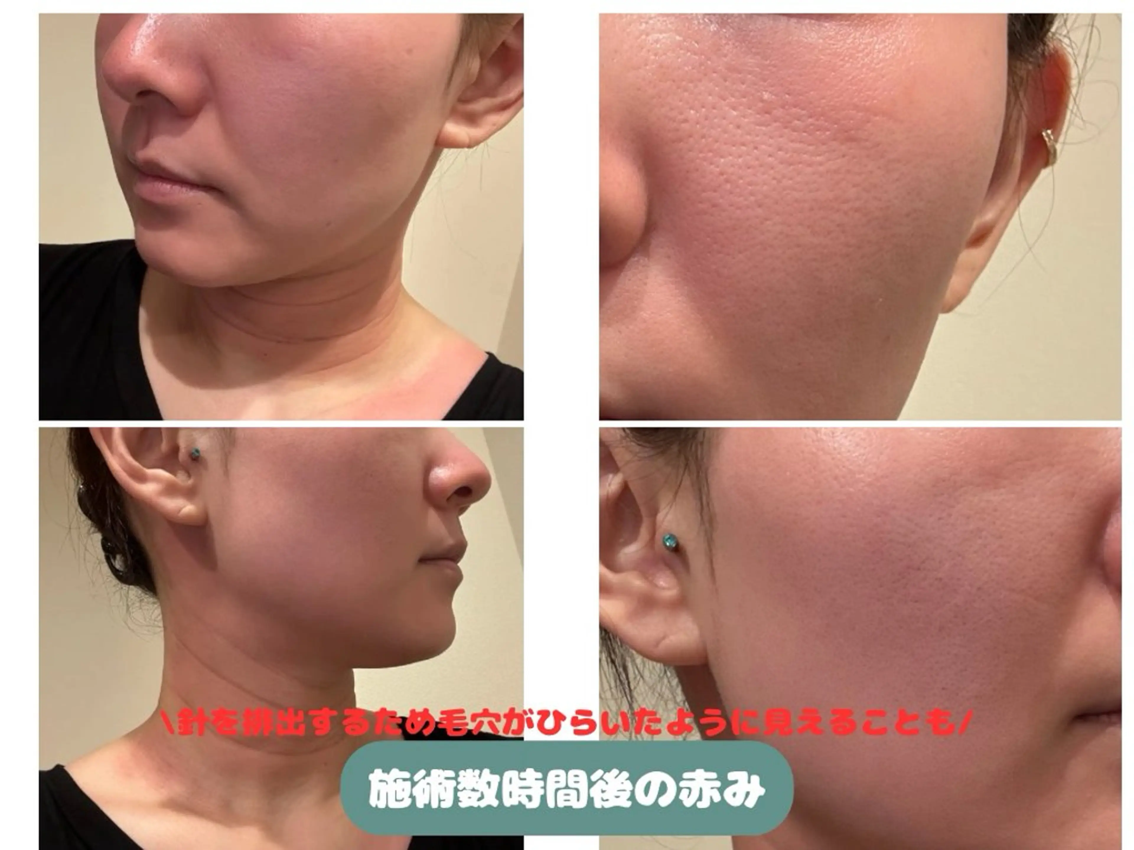 VIKI BEAUTY  クレイハーブピーリング・美肌脱毛専門店所属・VIKI BEAUTYのエステ・リラクイメージ