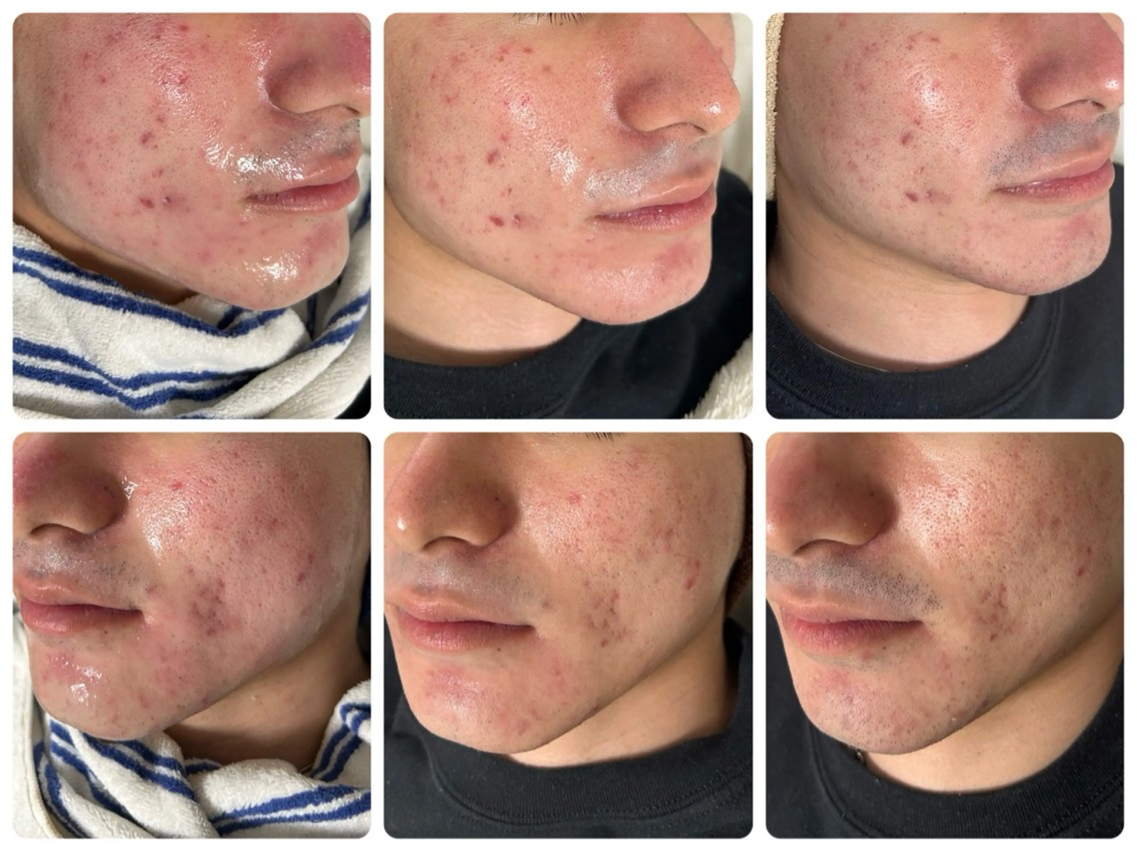 エステ 毛穴・肌質改善サロン ✨Tomaのその他イメージ