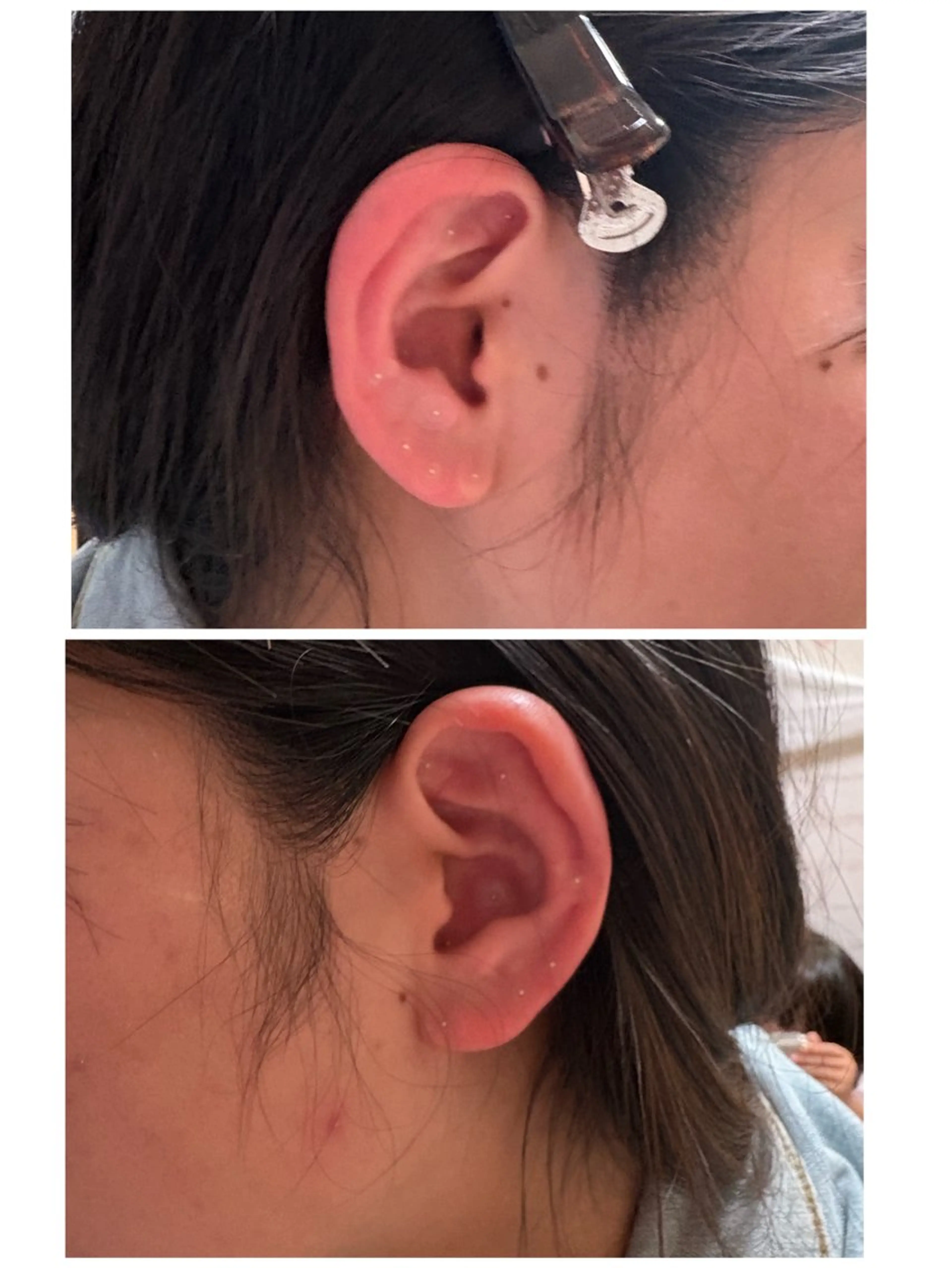 MION所属・耳つぼ ayaのその他イメージ