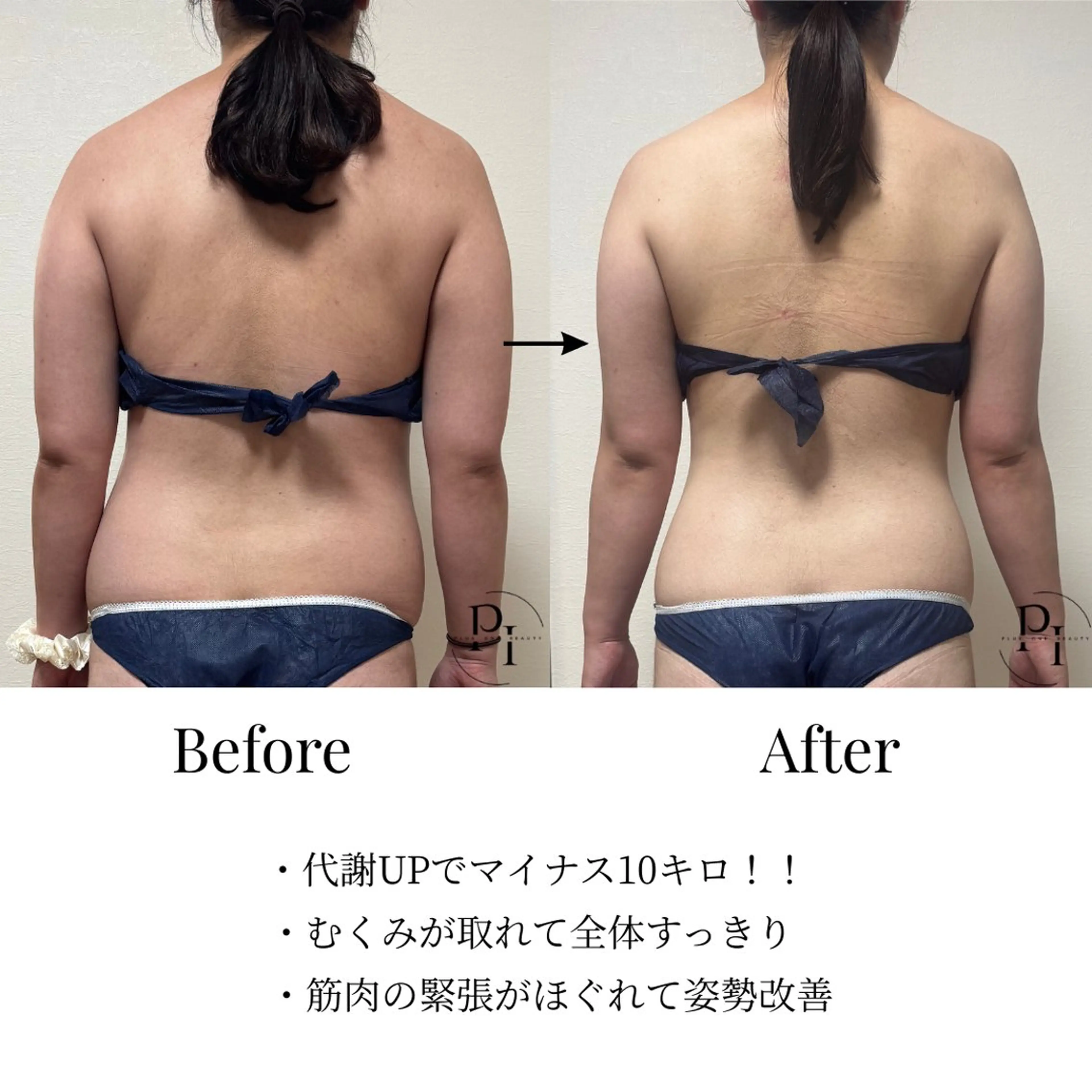 Plus One Beauty所属・【新大阪】痩身/小顔 美肌フェイシャルのエステ・リラクイメージ