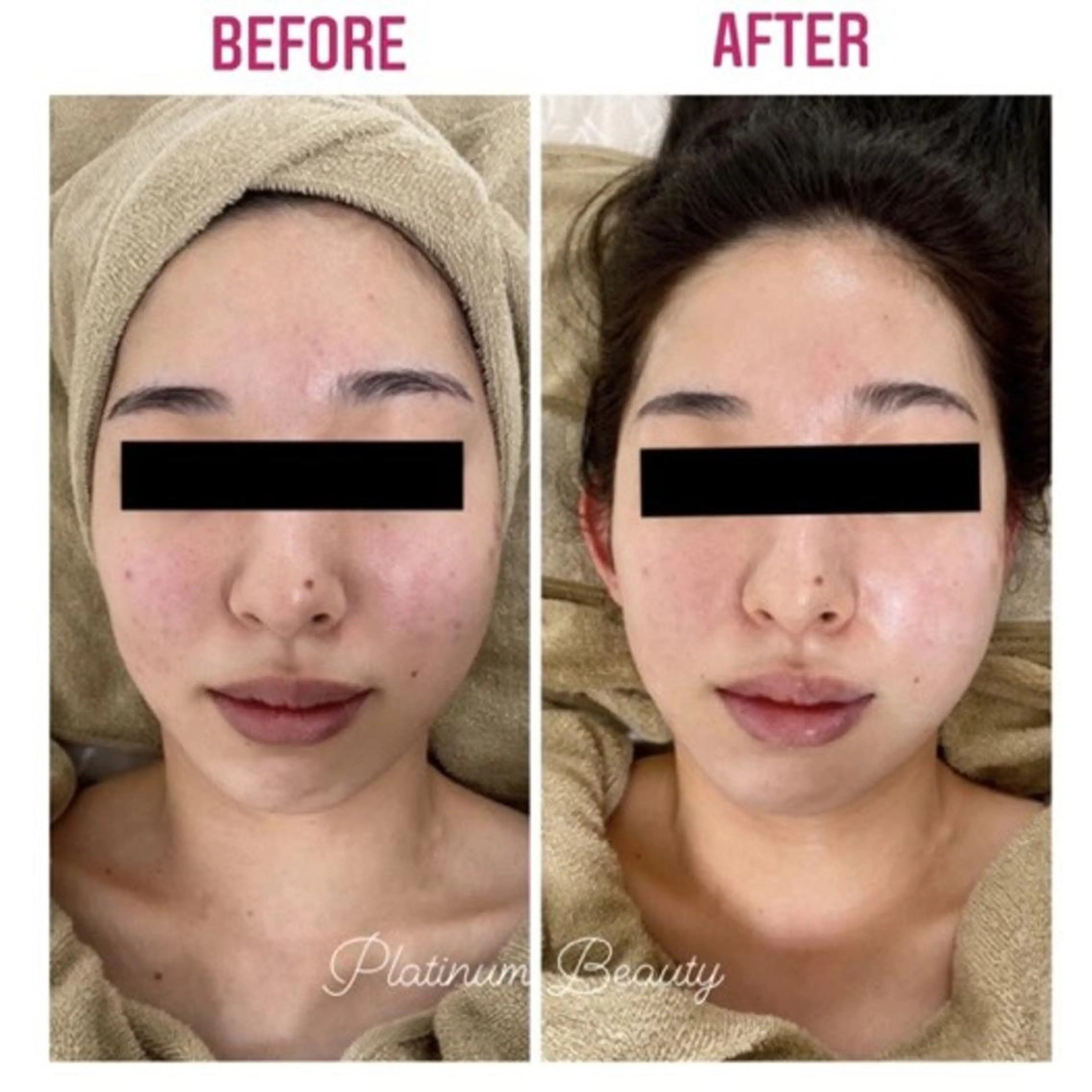 プラティーヌ ボーテのその他イメージ