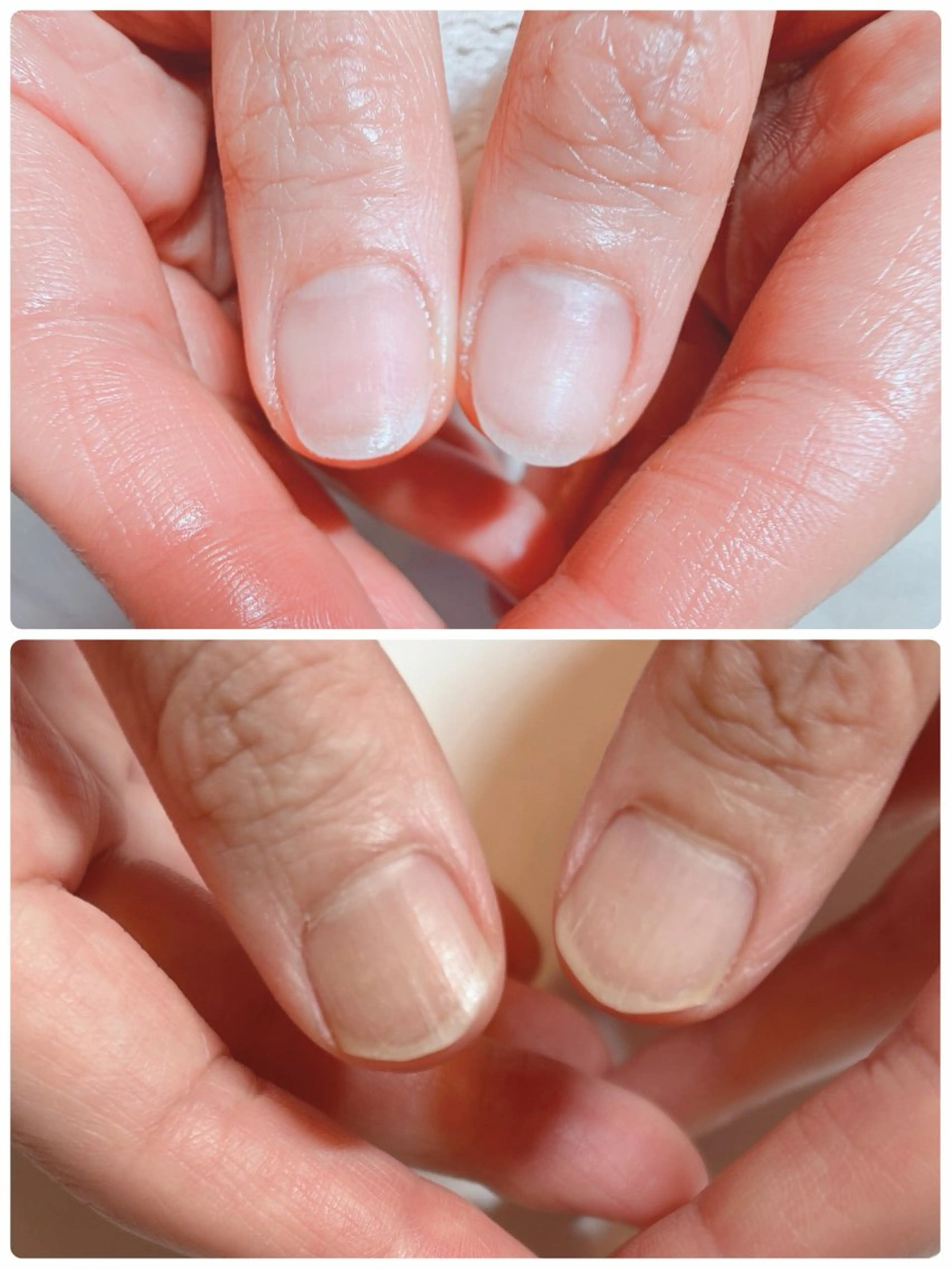 ネイル スカルプネイル 近藤 麻子のヘアスタイル