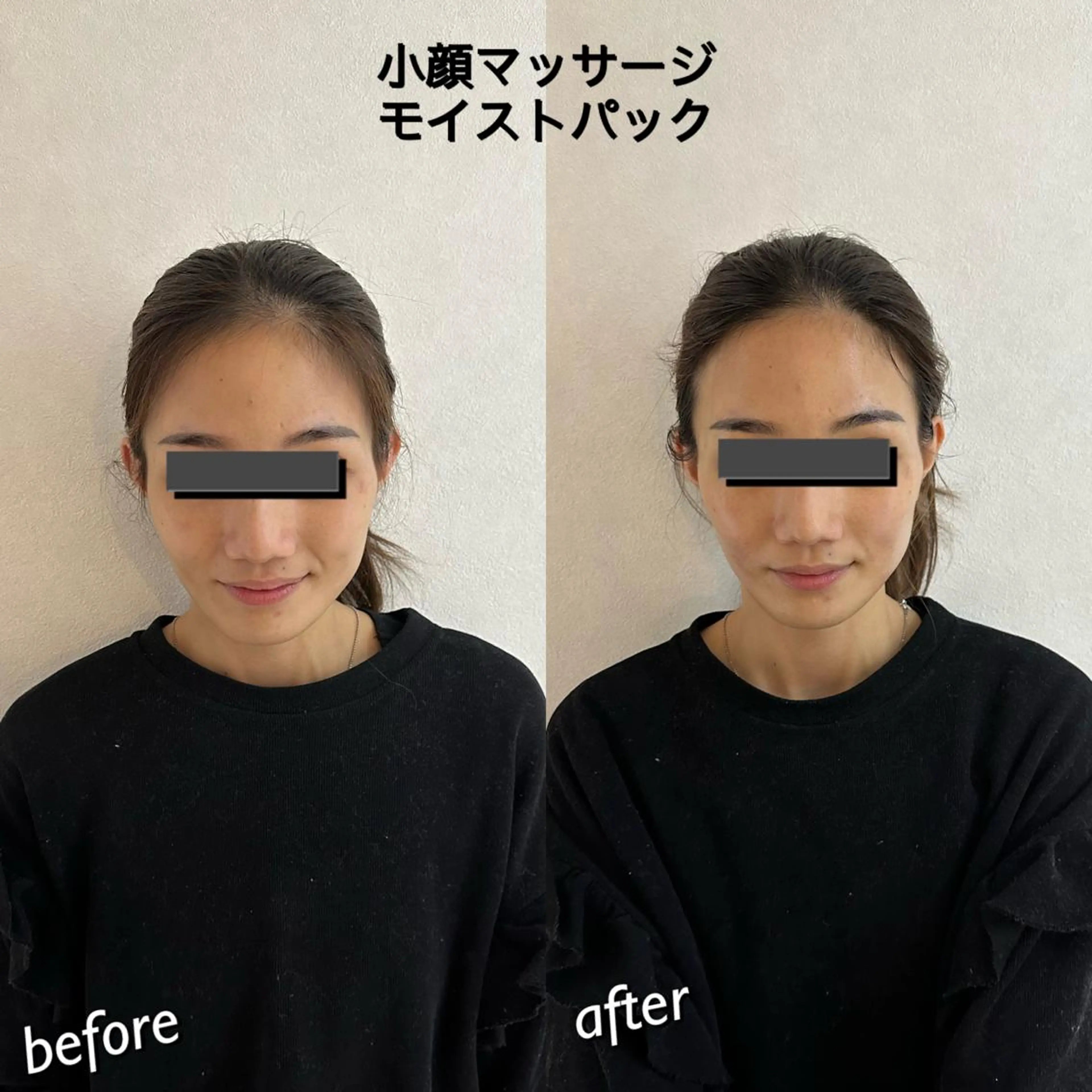 うなじ脱毛/美肌脱毛 LABELのエステ・リラクイメージ