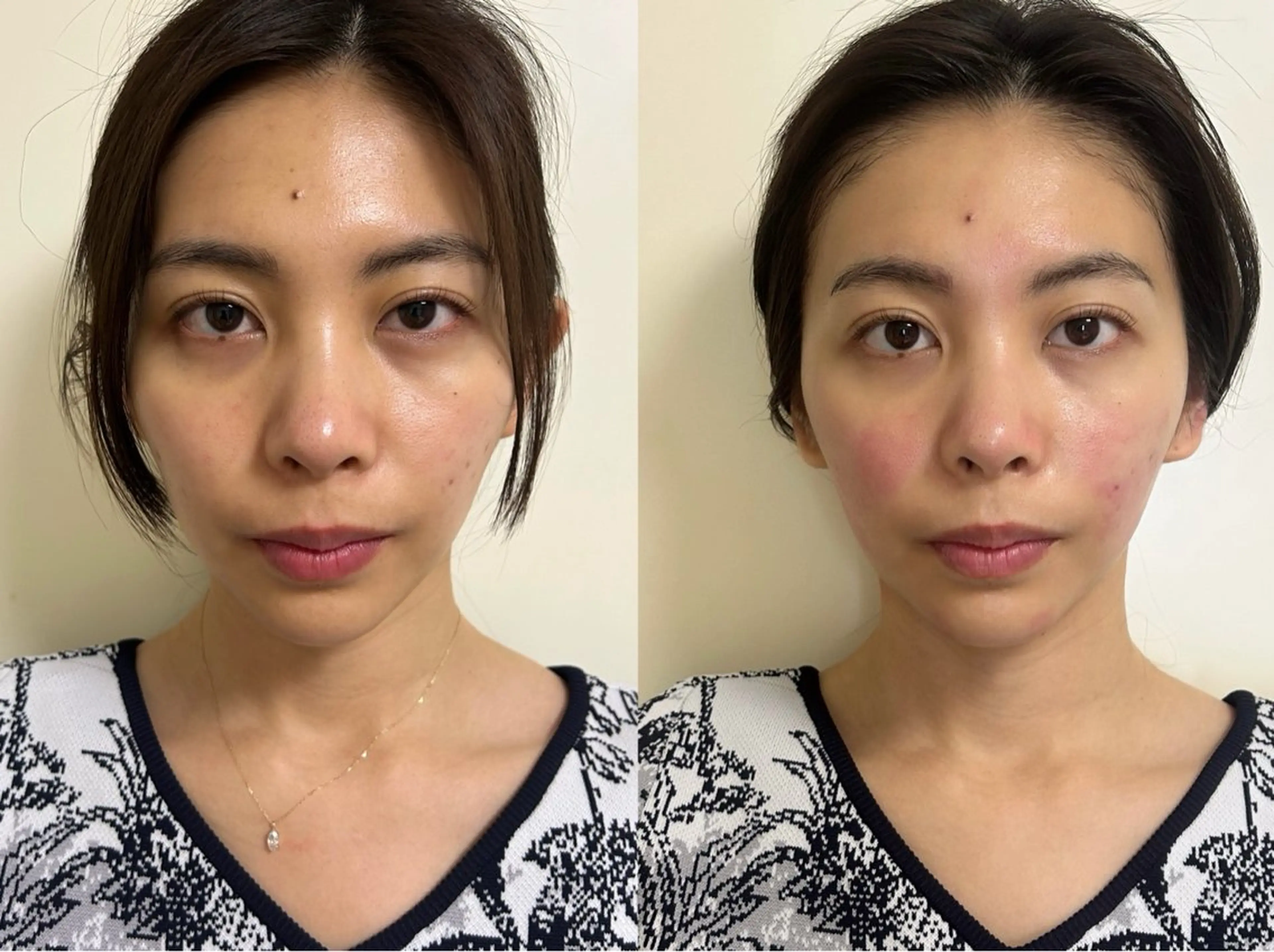 美容鍼灸サロン mahoroba院長のエステ・リラクイメージ