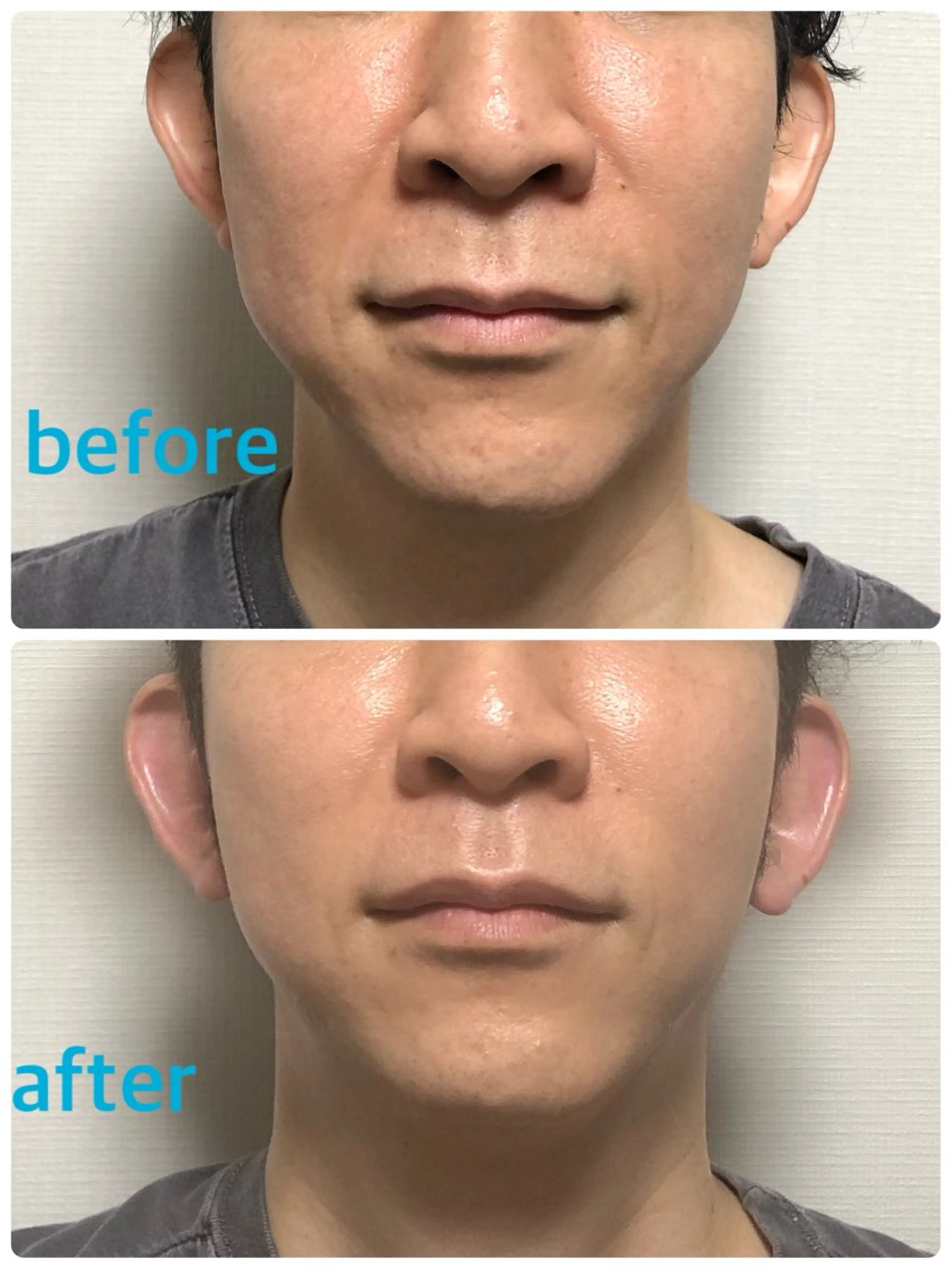 メンズ 安眠ヘッドスパ整体 🌿白金/目黒/鈴木のエステ・リラクイメージ