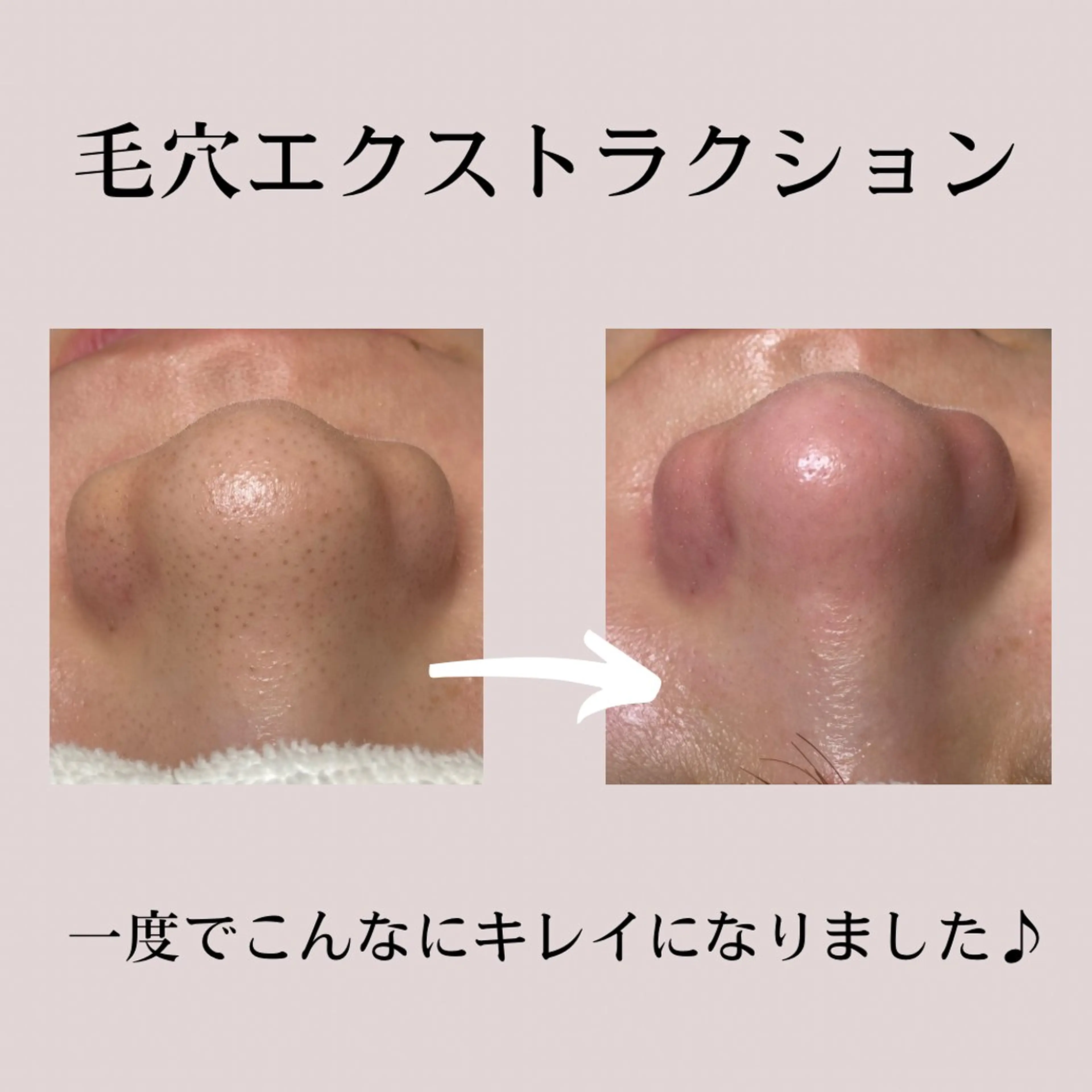 carpe Maraisのヘアスタイル