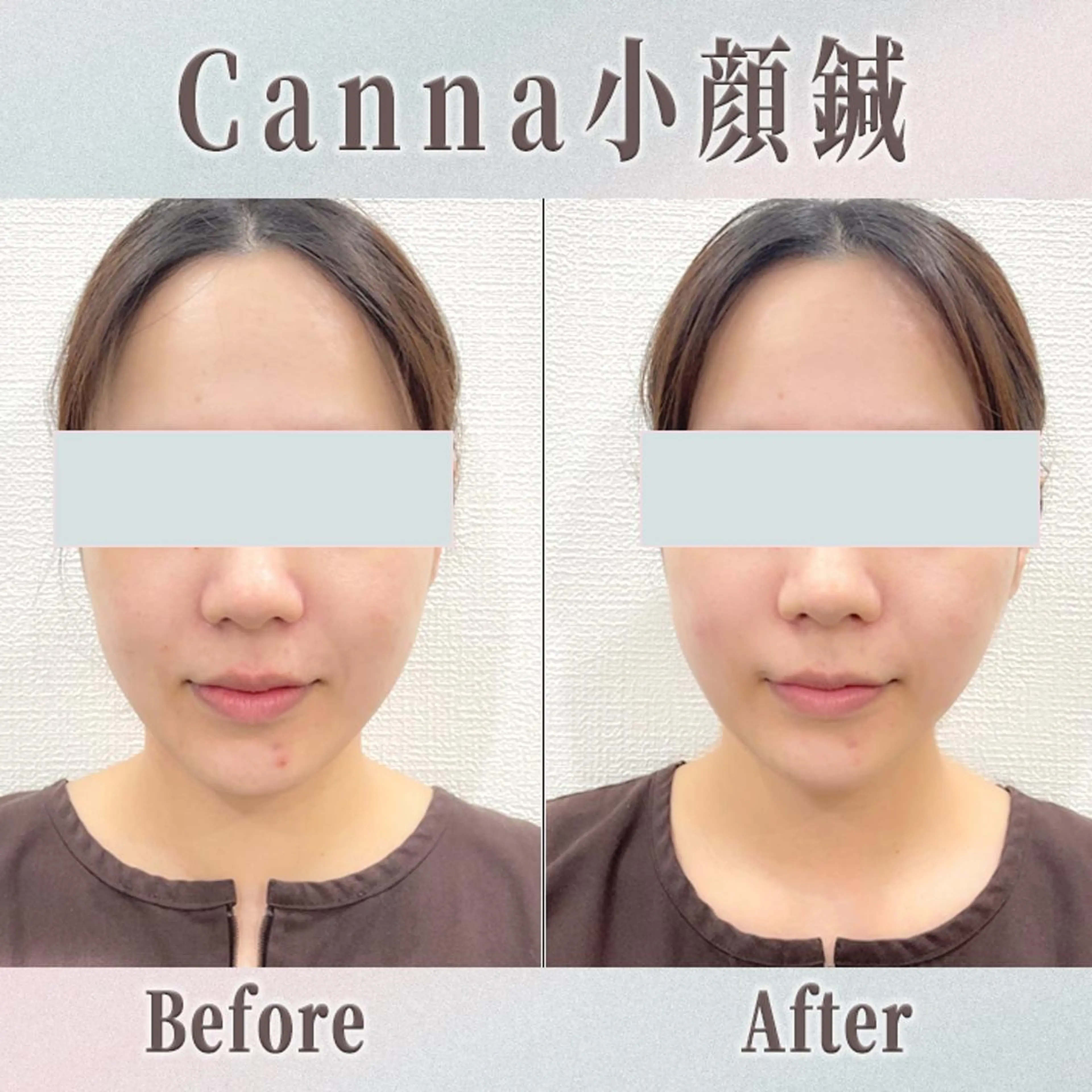 エステ リラク 【美容鍼・小顔鍼】 鍼灸師　森原拓磨のエステ・リラクイメージ