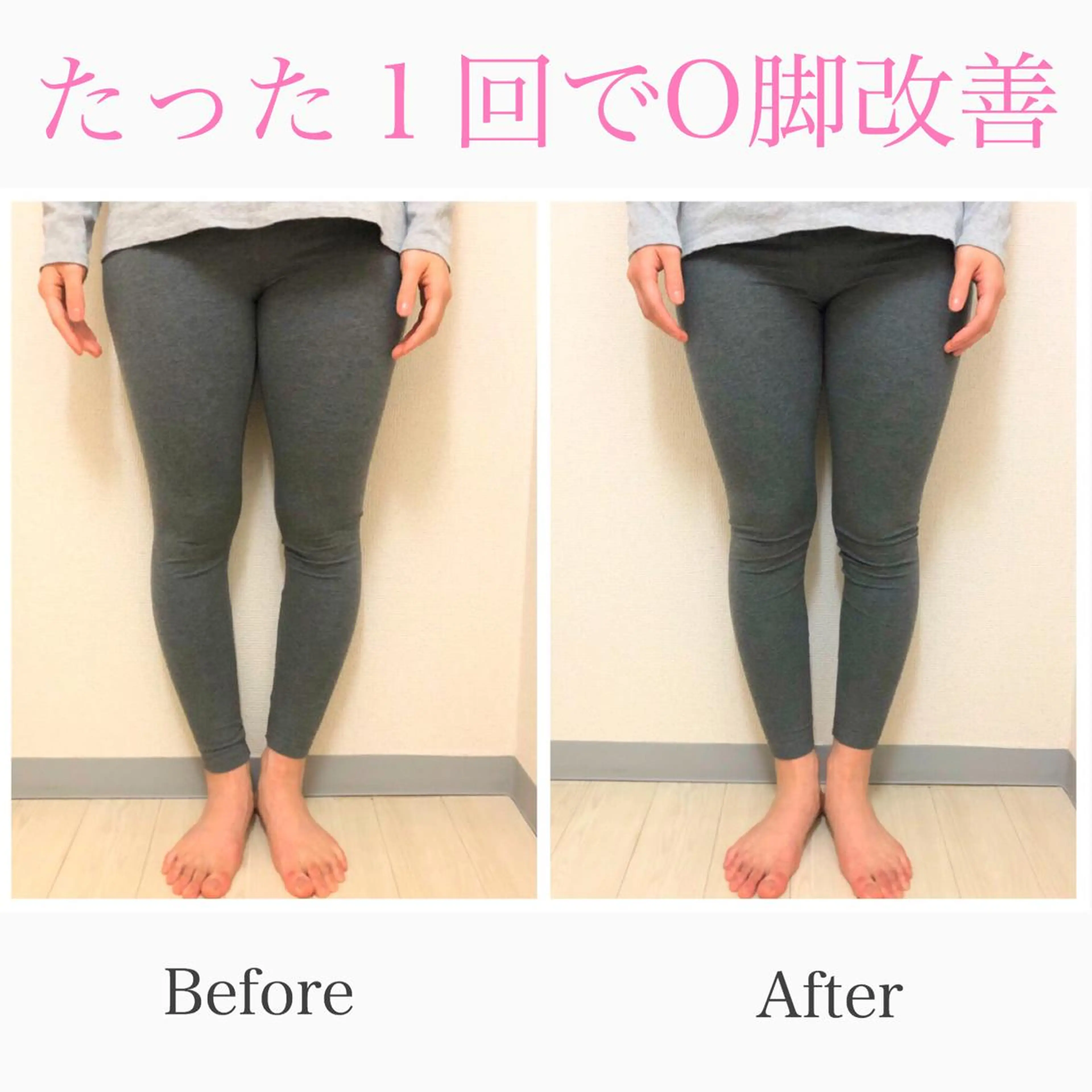 小顔モニター 募集のエステ・リラクイメージ