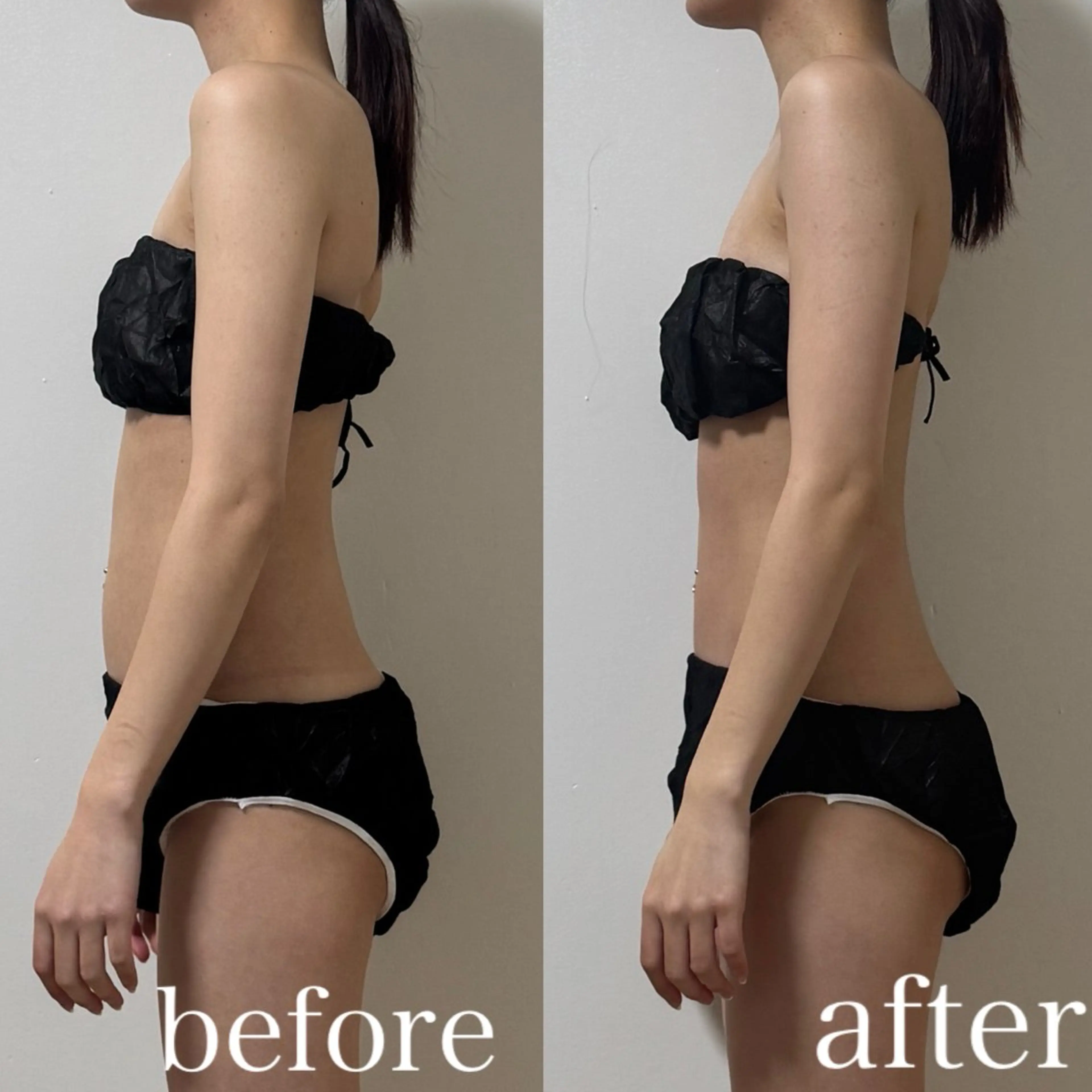 ご新規様限定¥3000オフ！上半身筋膜リリース×リンパケア70分の写真