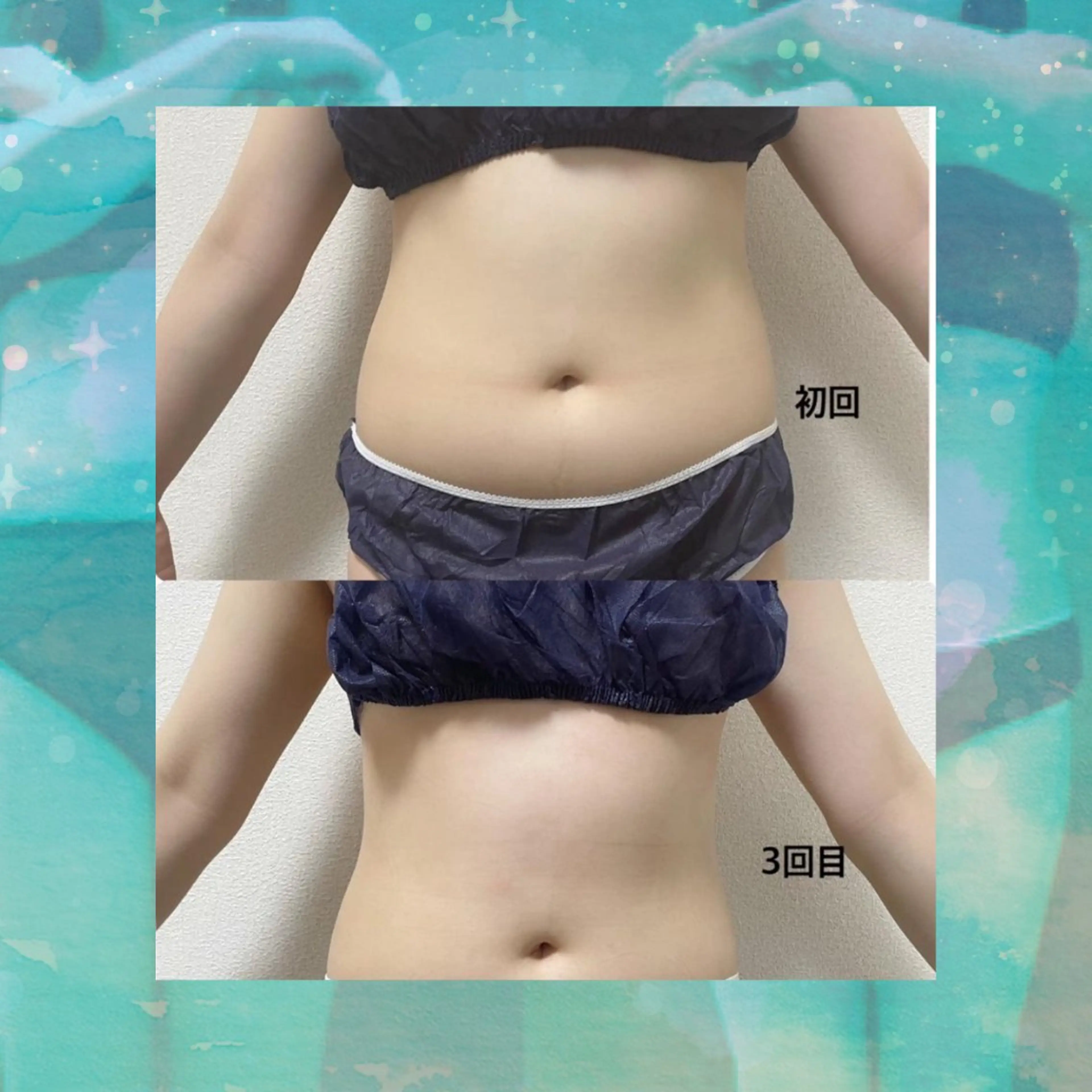 マツエク・マツパ 結婚式・ブライダル エステ リラク 愛維美水光美肌専門店 メンズレディースokのエステ・リラクイメージ