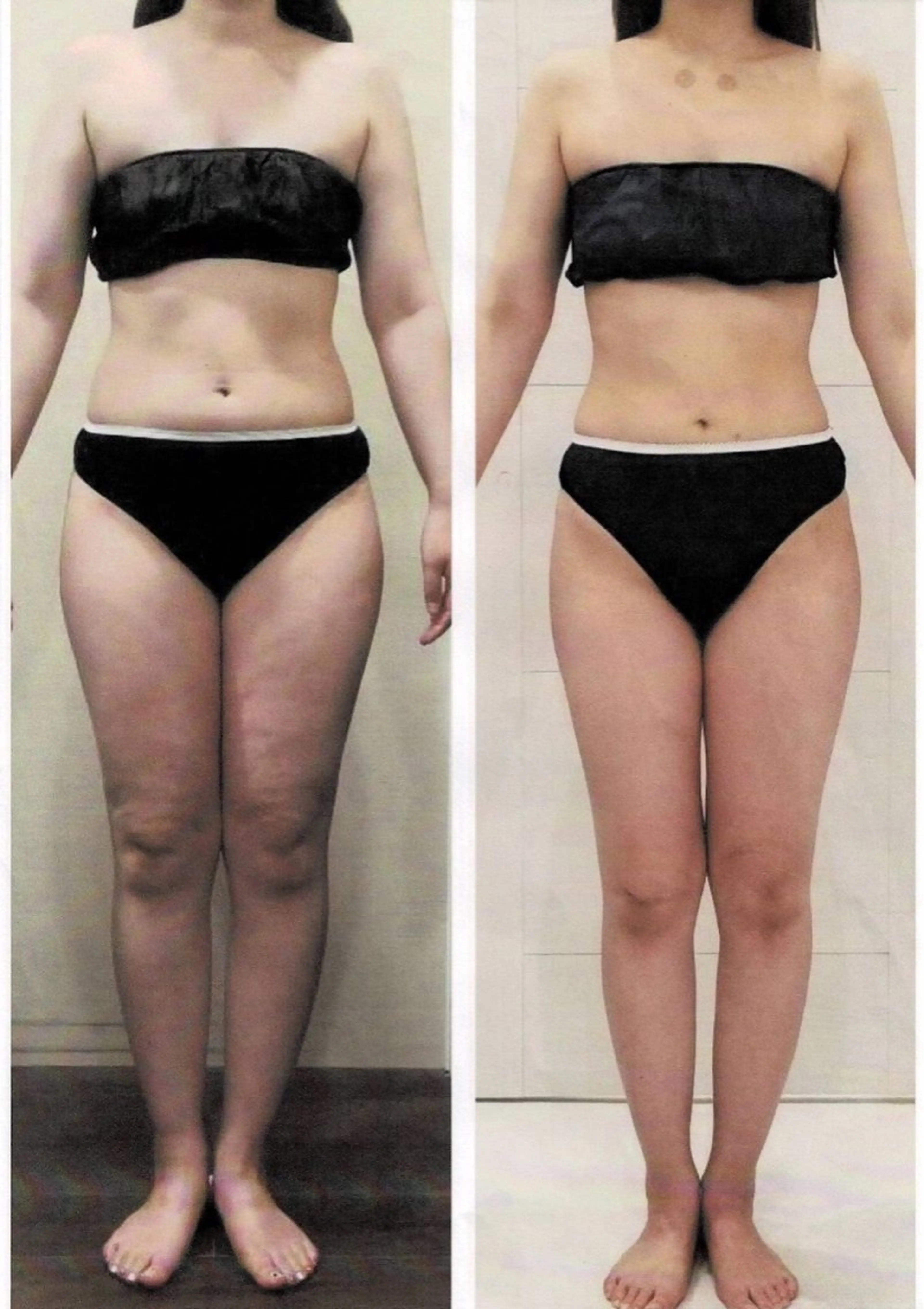 トータルビューティー リアラココ　上田仁美のその他イメージ