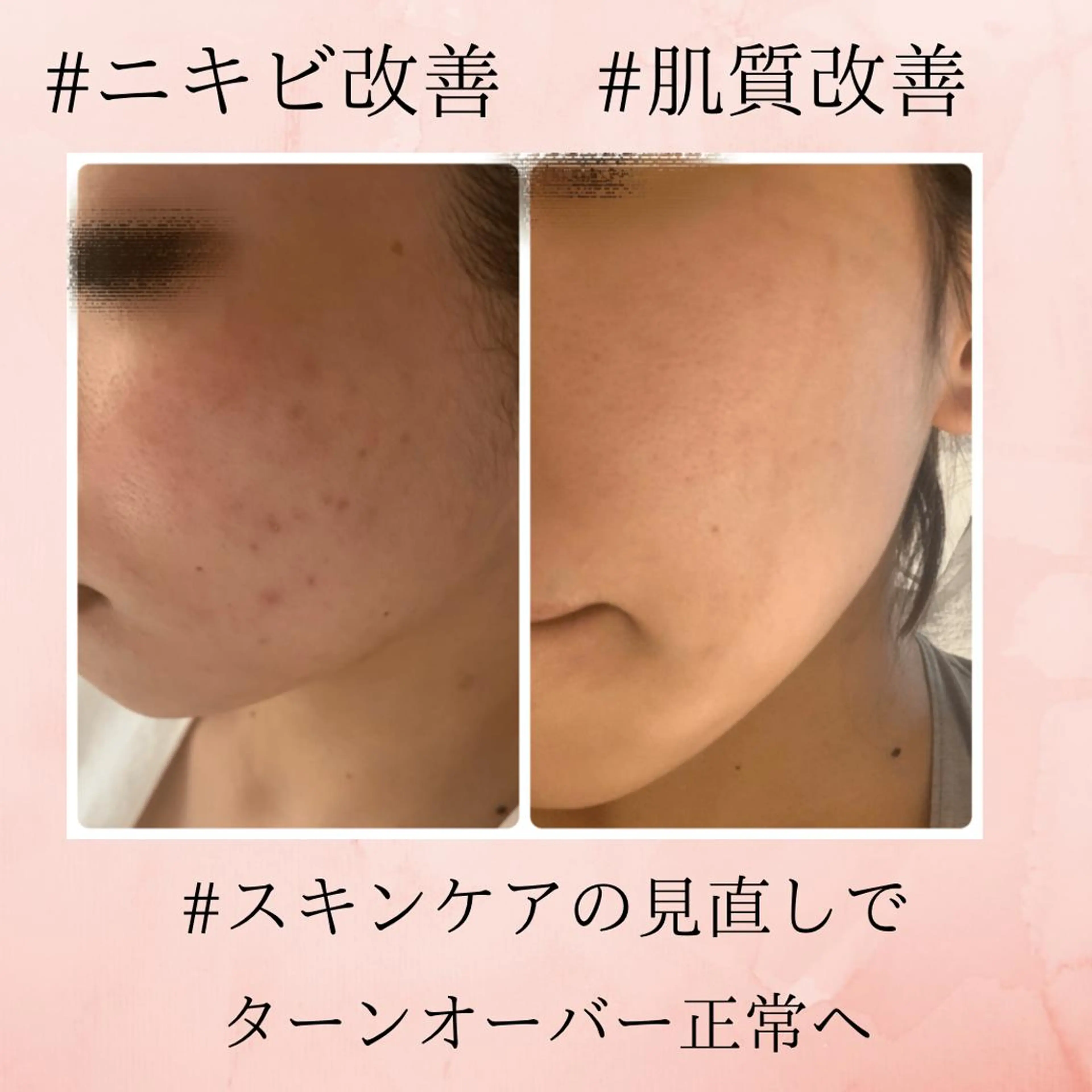 リラクゼーションエステサロン🌺肌質改善イアリイ所属・肌質再生 〜イア🌺リイ〜のエステ・リラクイメージ