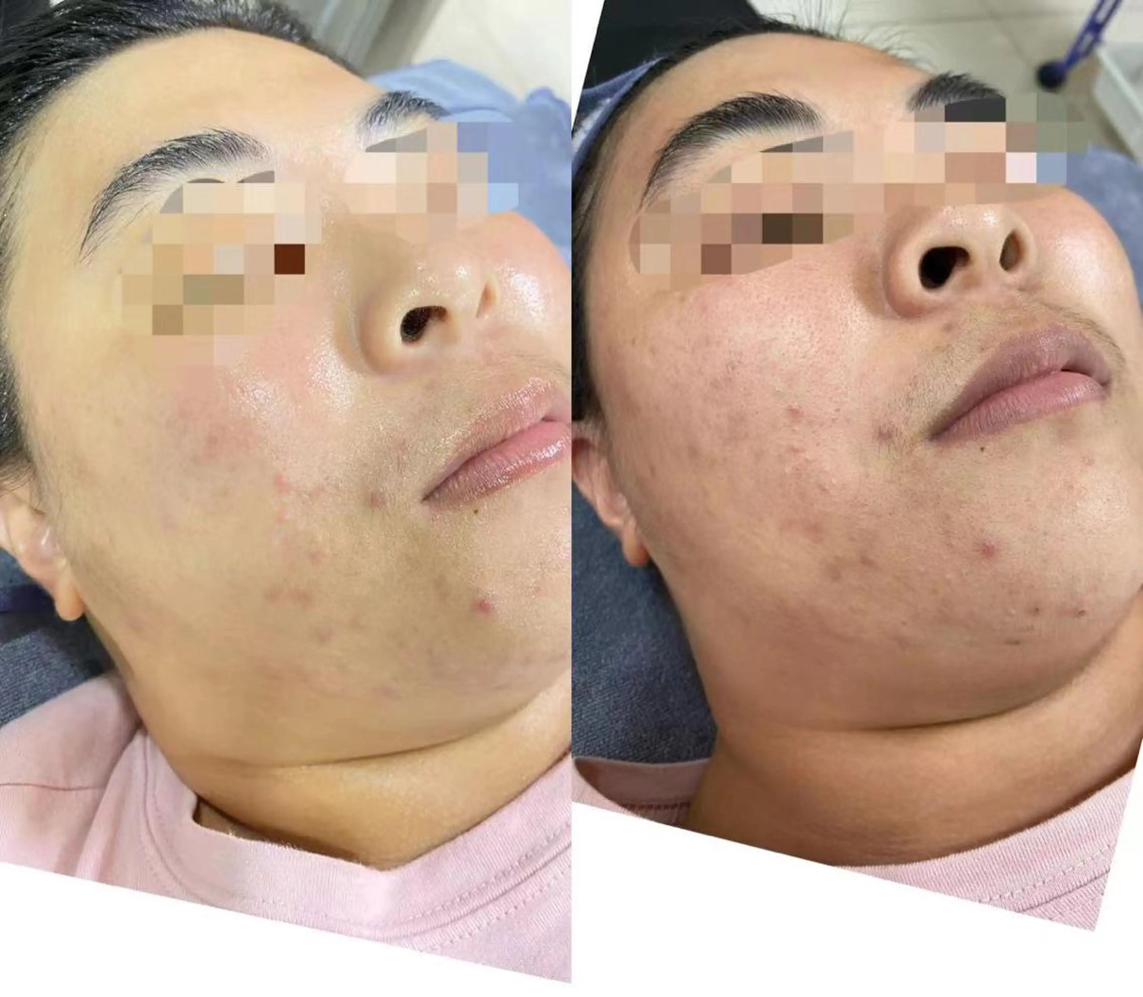 この花 エステサロンのエステ・リラクイメージ