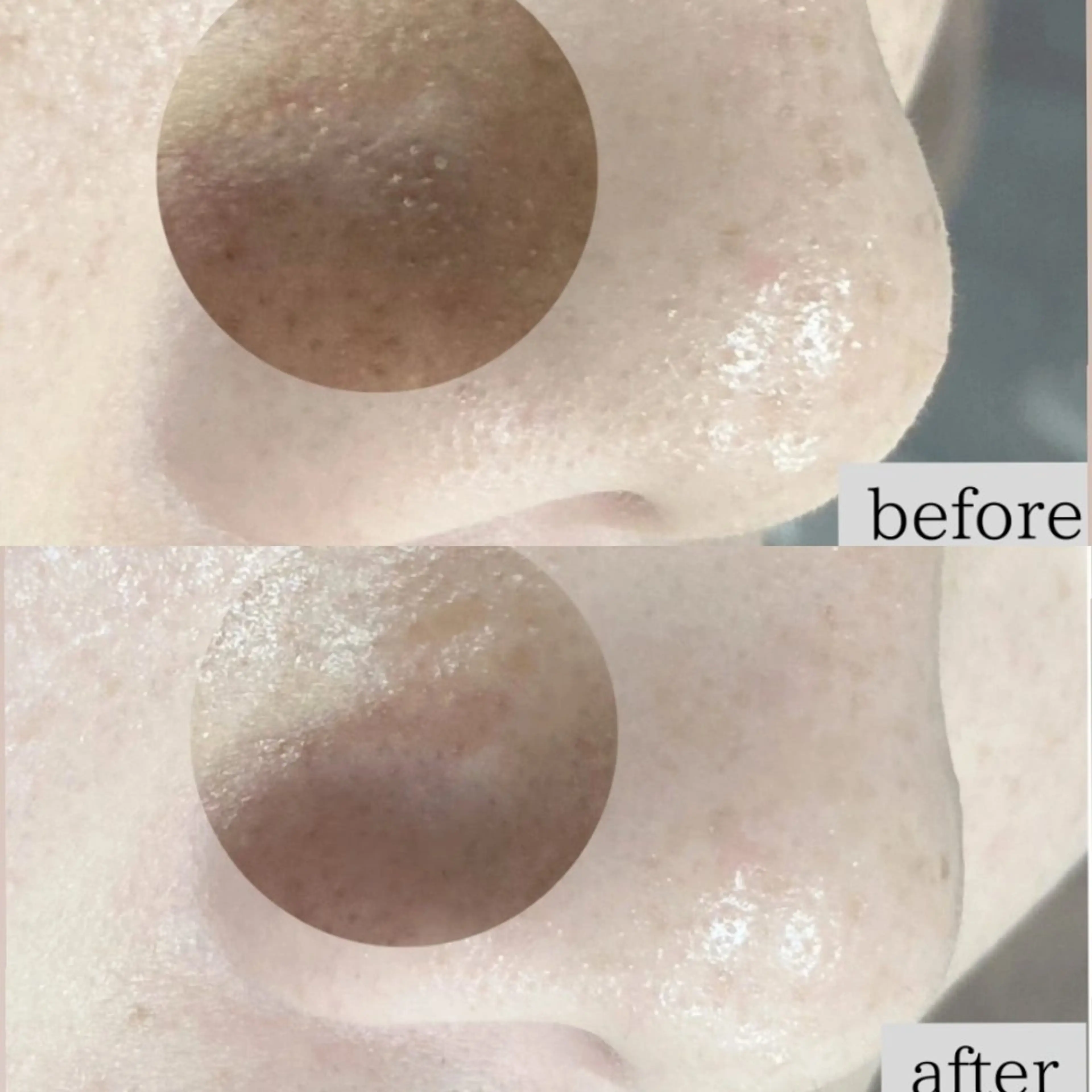 エステ Dahlia痩身脱毛 フェイシャル 中村のエステ・リラクイメージ