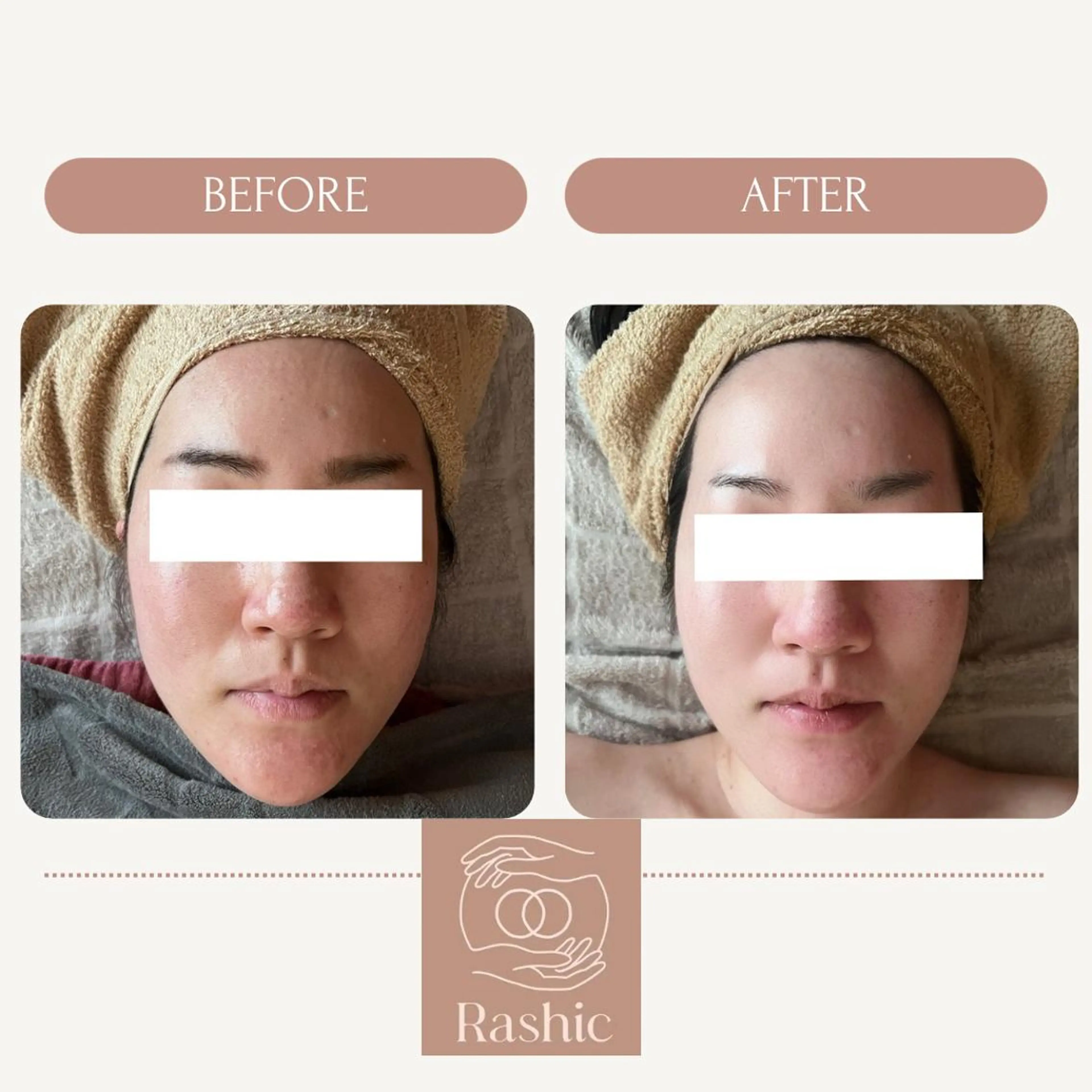 エステ リラク ReN エステサロンのエステ・リラクイメージ