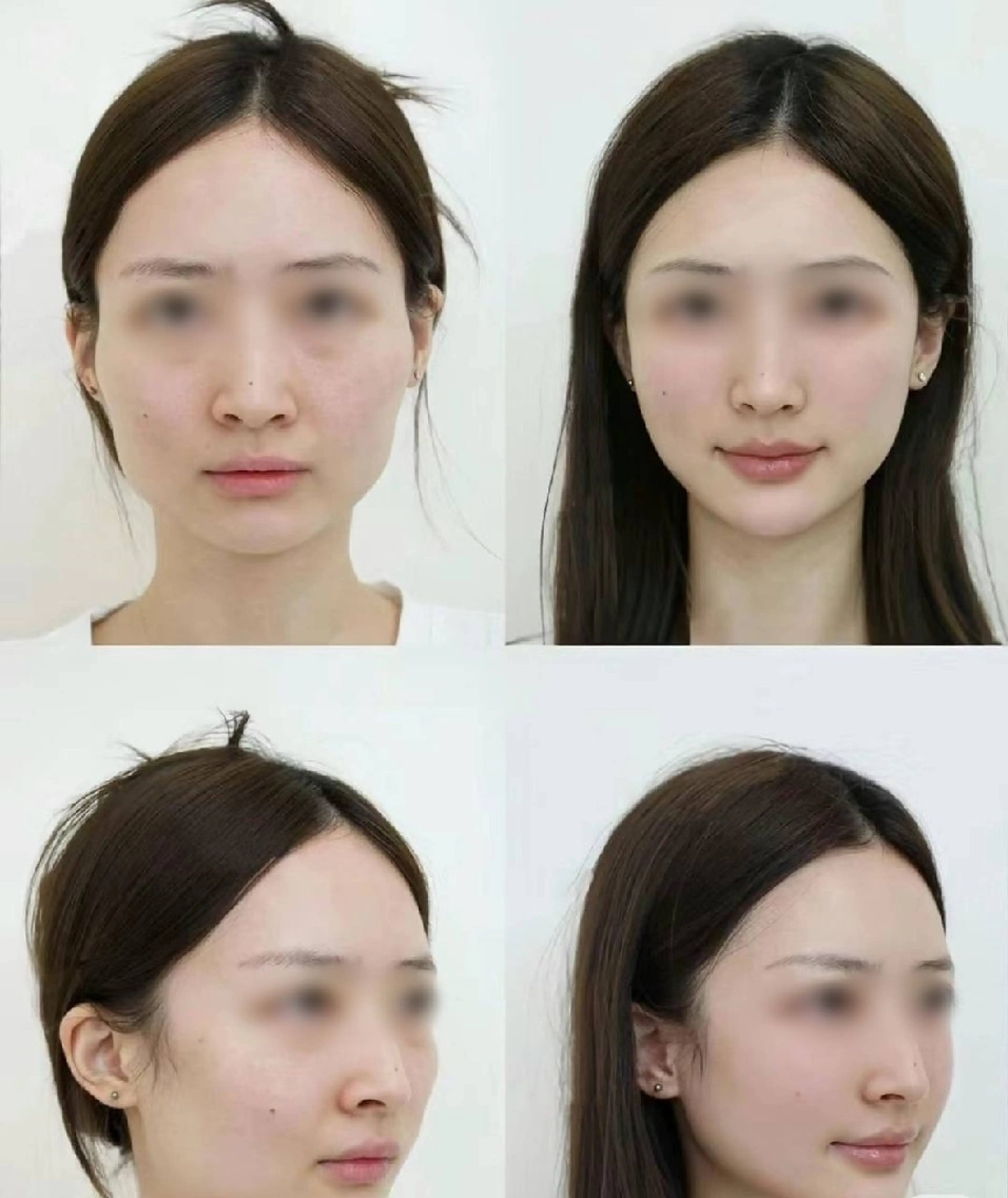 マツエク・マツパ 結婚式・ブライダル aliaハーブ水光店 エステティシャン募集のエステ・リラクイメージ