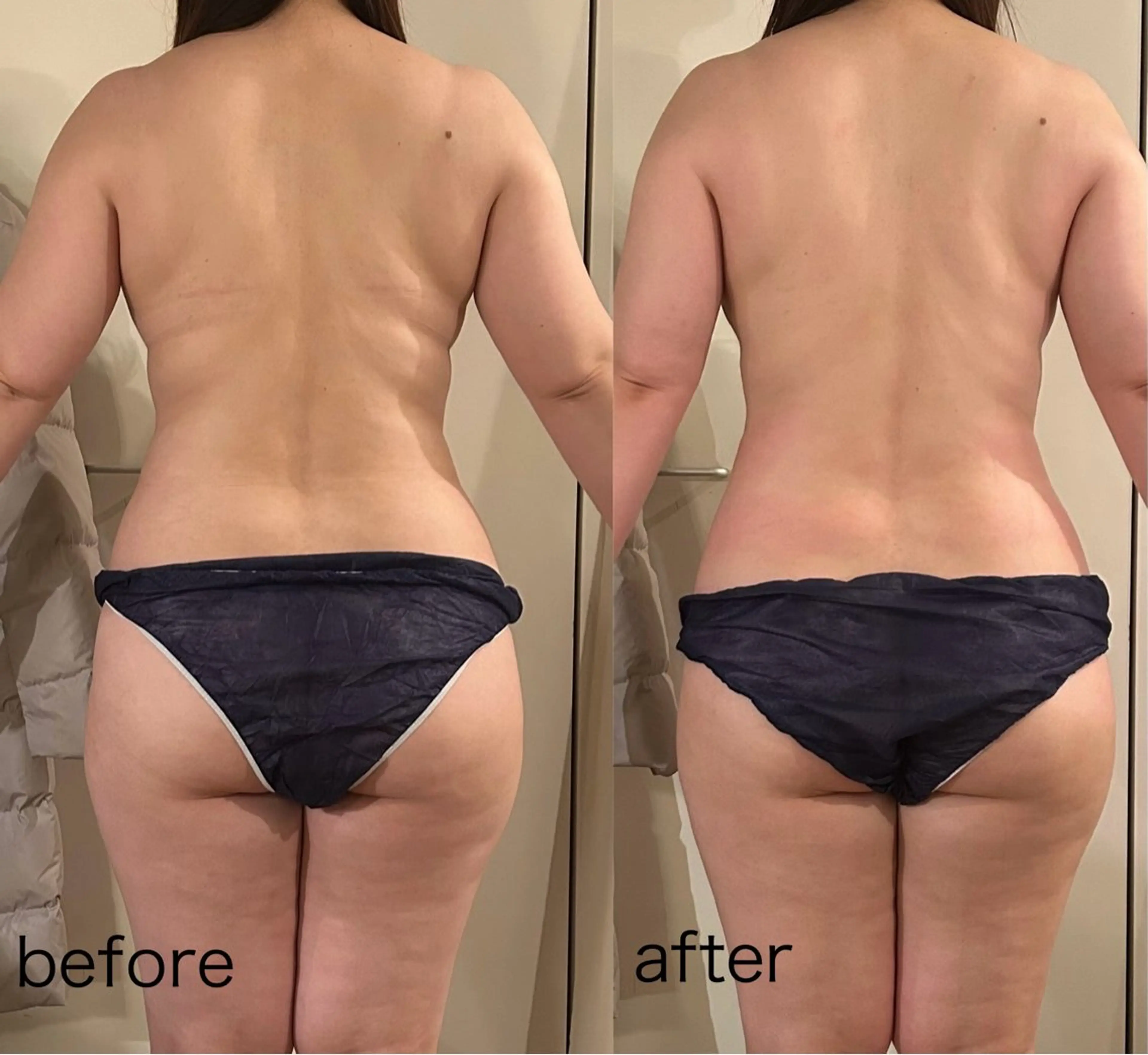 エステ リラク プライベートサロン シュシュのエステ・リラクイメージ