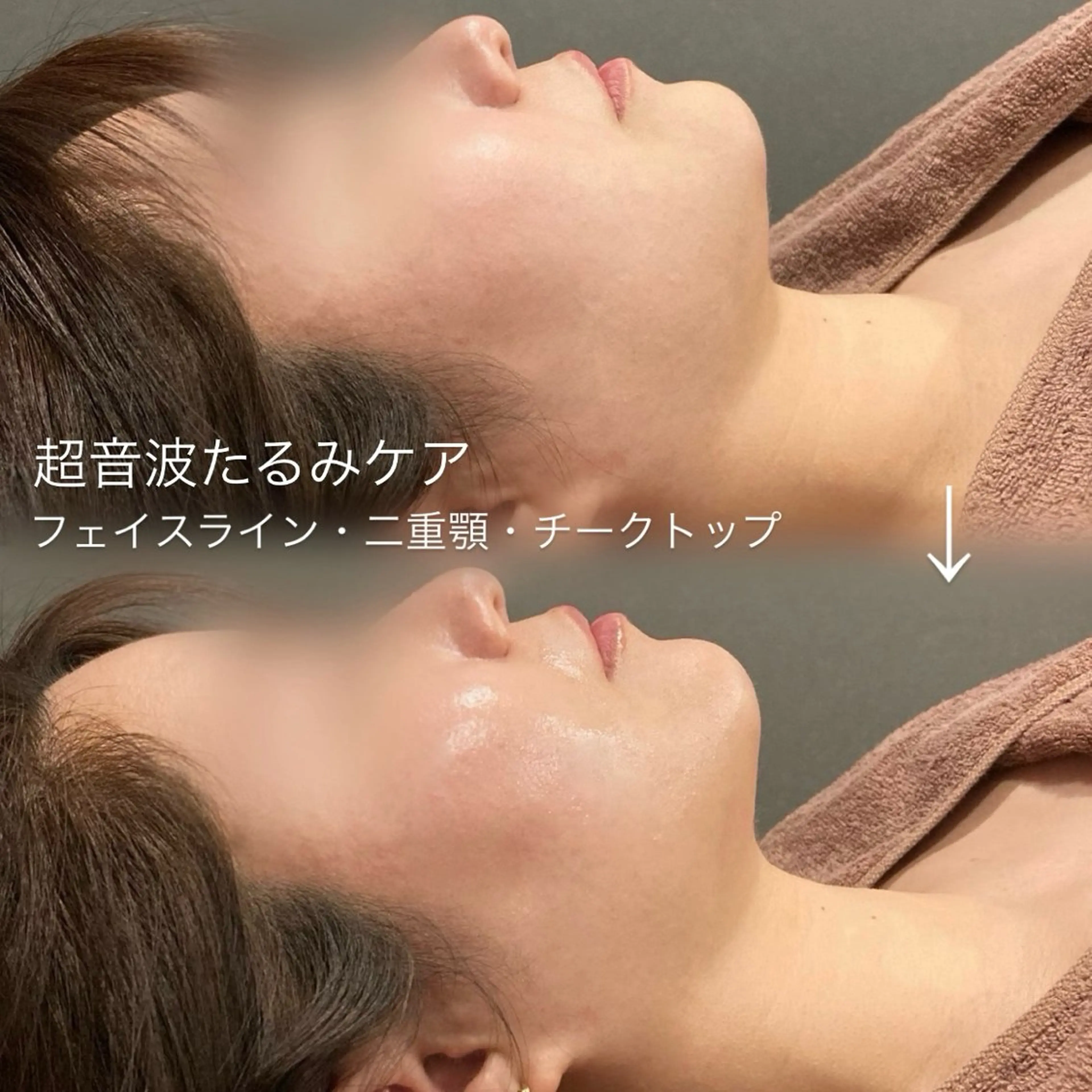 エステ salon 398所属・salon 398 Kyokoのマツエク・マツパデザイン