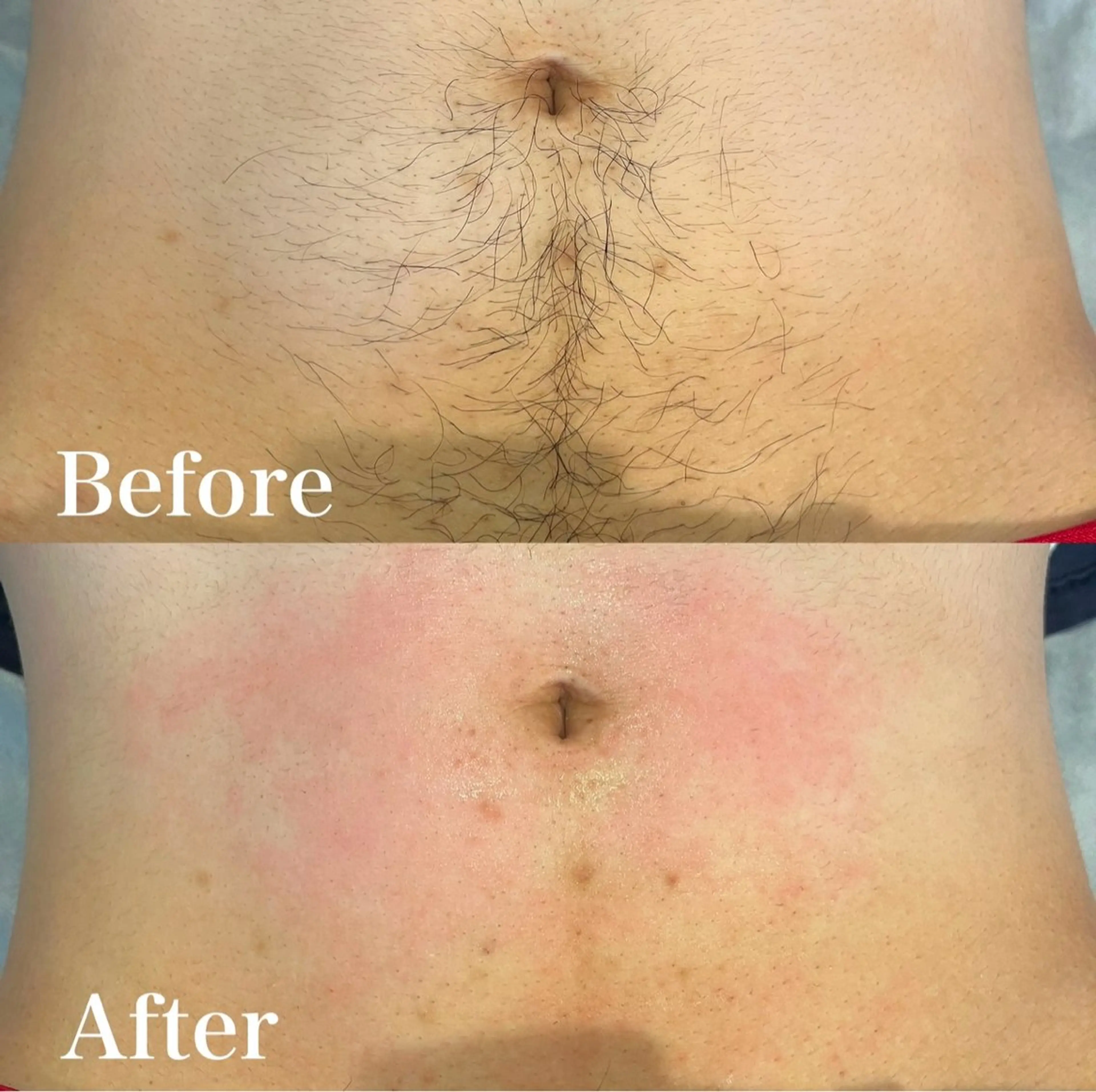 脱毛 wax脱毛専門店 ハイラントのエステ・リラクイメージ