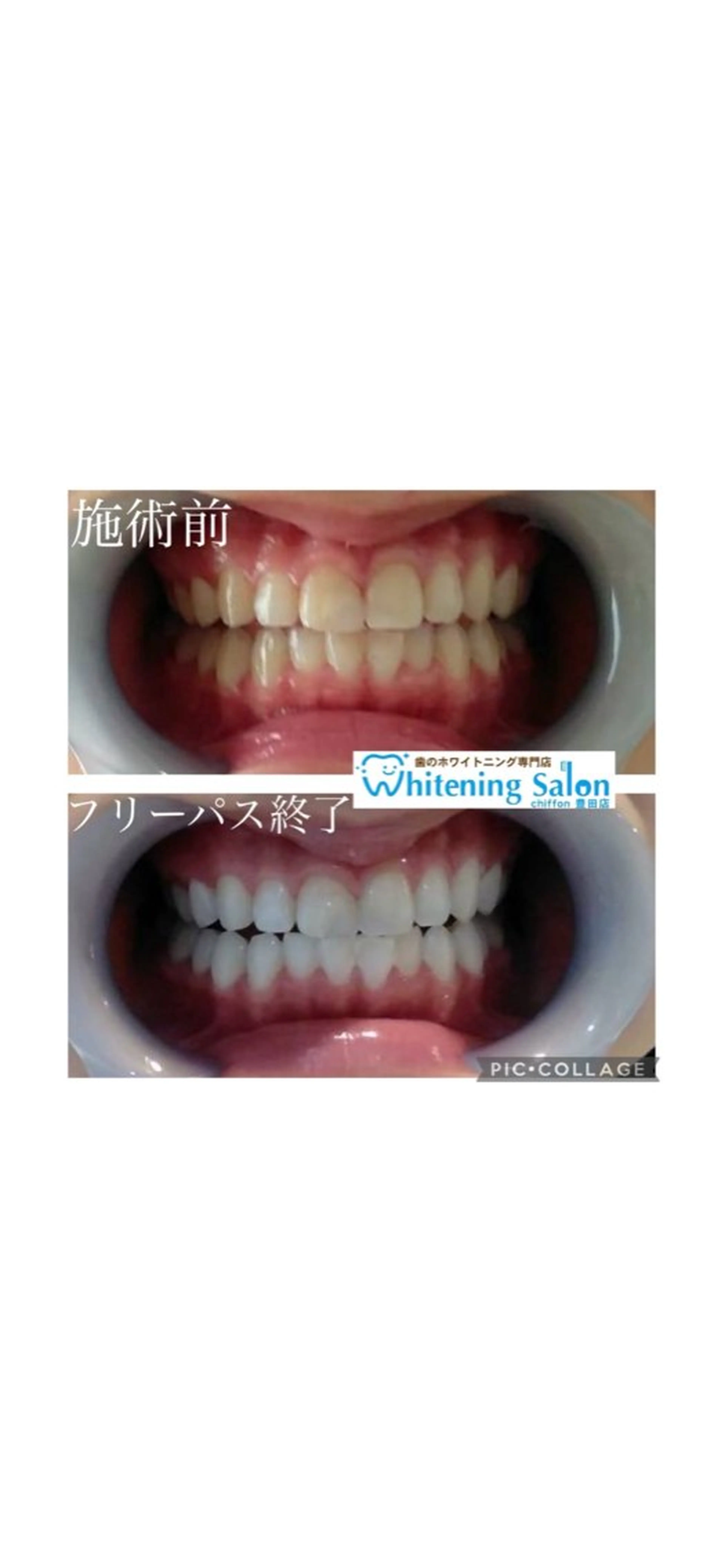 ホワイトニングサロン シフォン豊田店のエステ・リラクイメージ