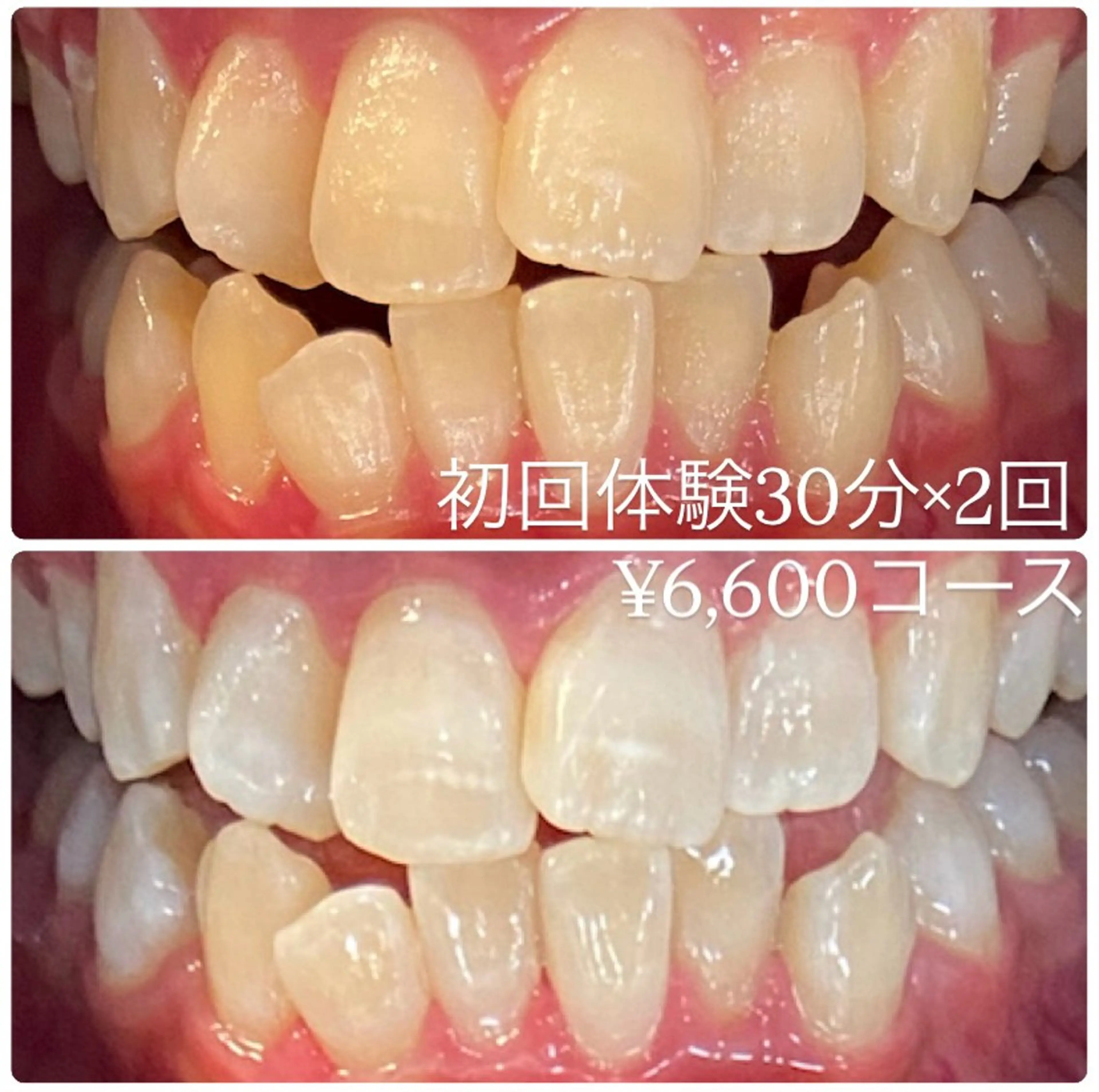 ホワイトニングルーム 横浜店のその他イメージ