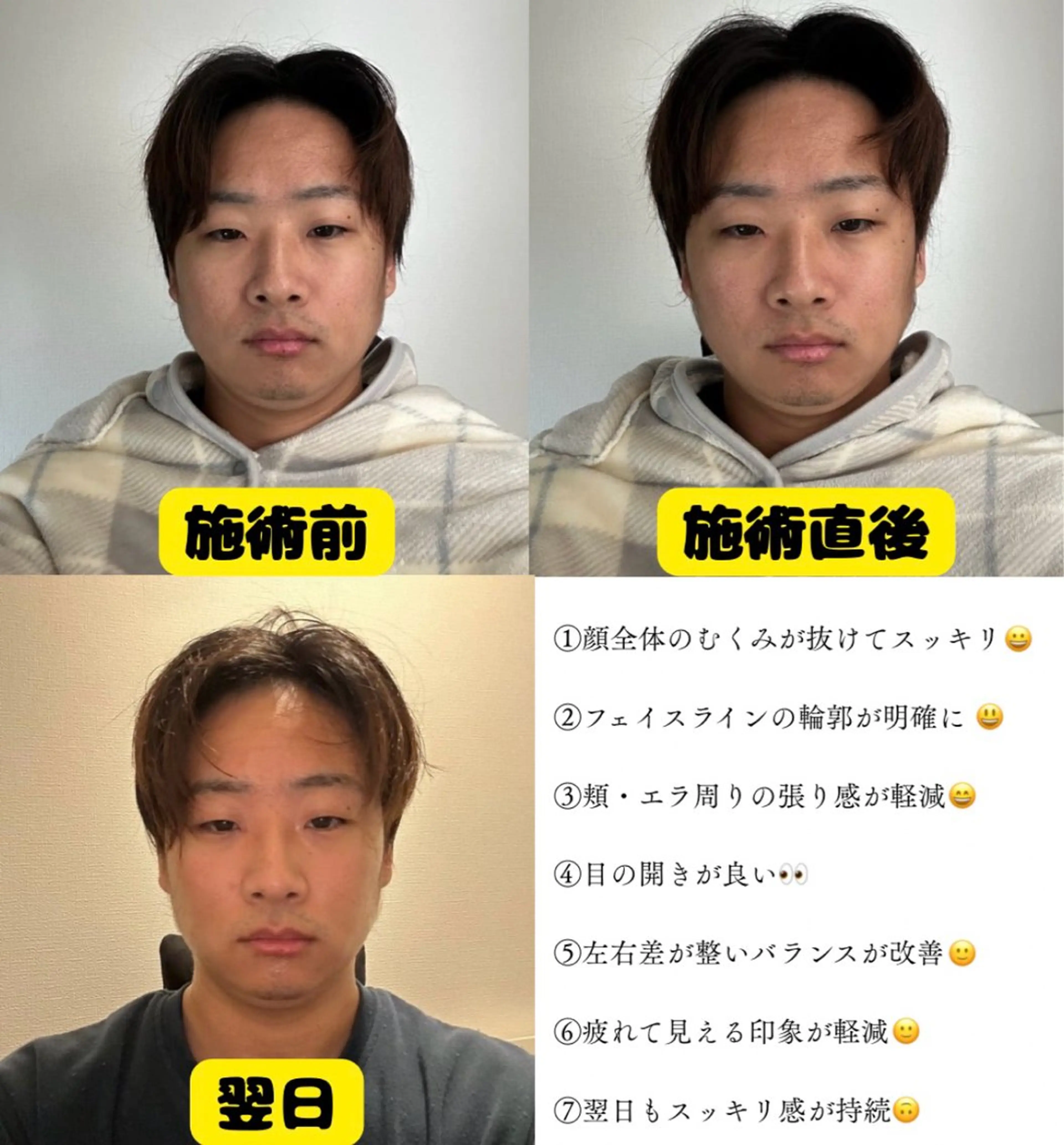 【フェイス】疲れ顔/垂れ下がり顔リセットコース【筋膜リリース】の写真