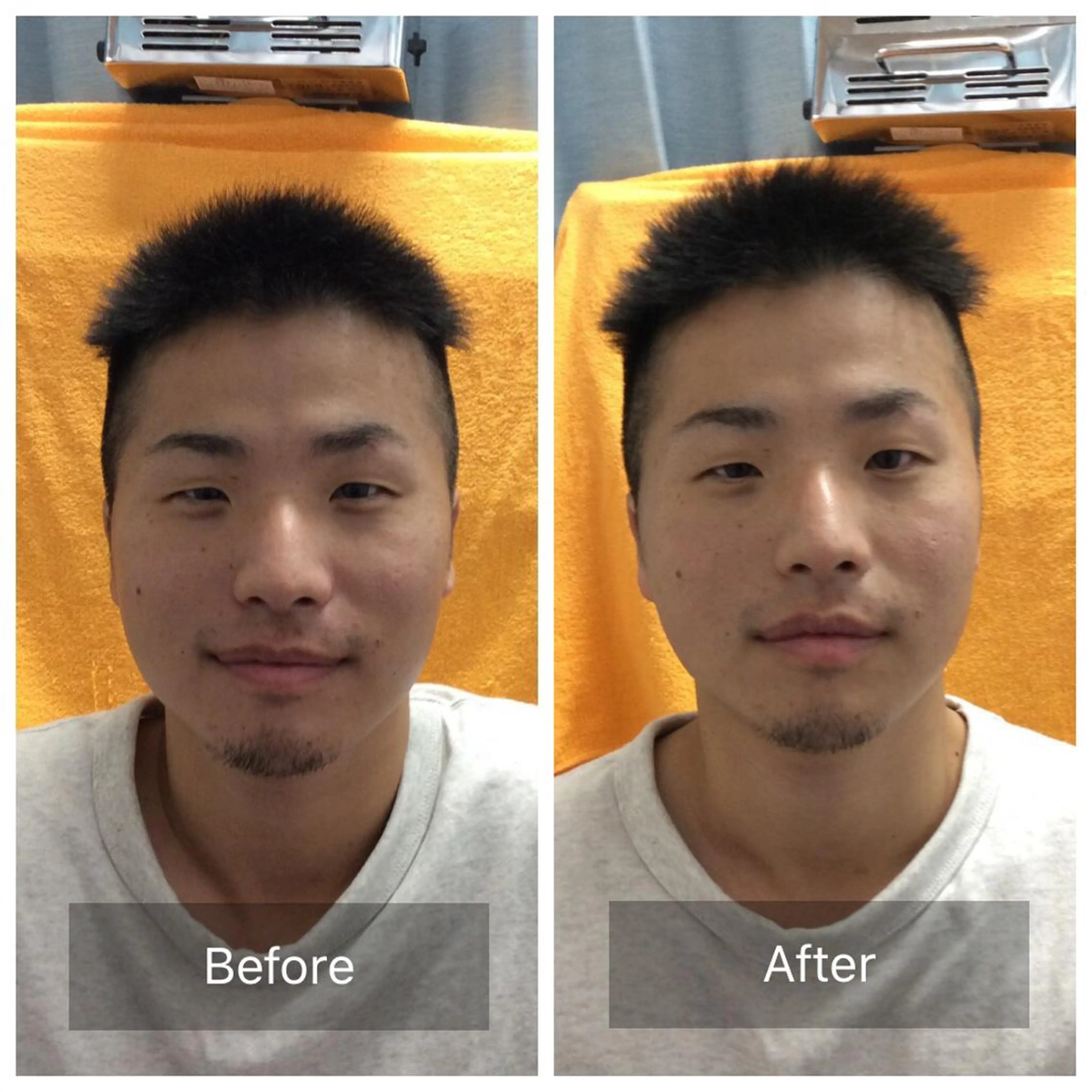 メンズ 美容鍼×小顔矯正× 美容整体/小林幸司のエステ・リラクイメージ