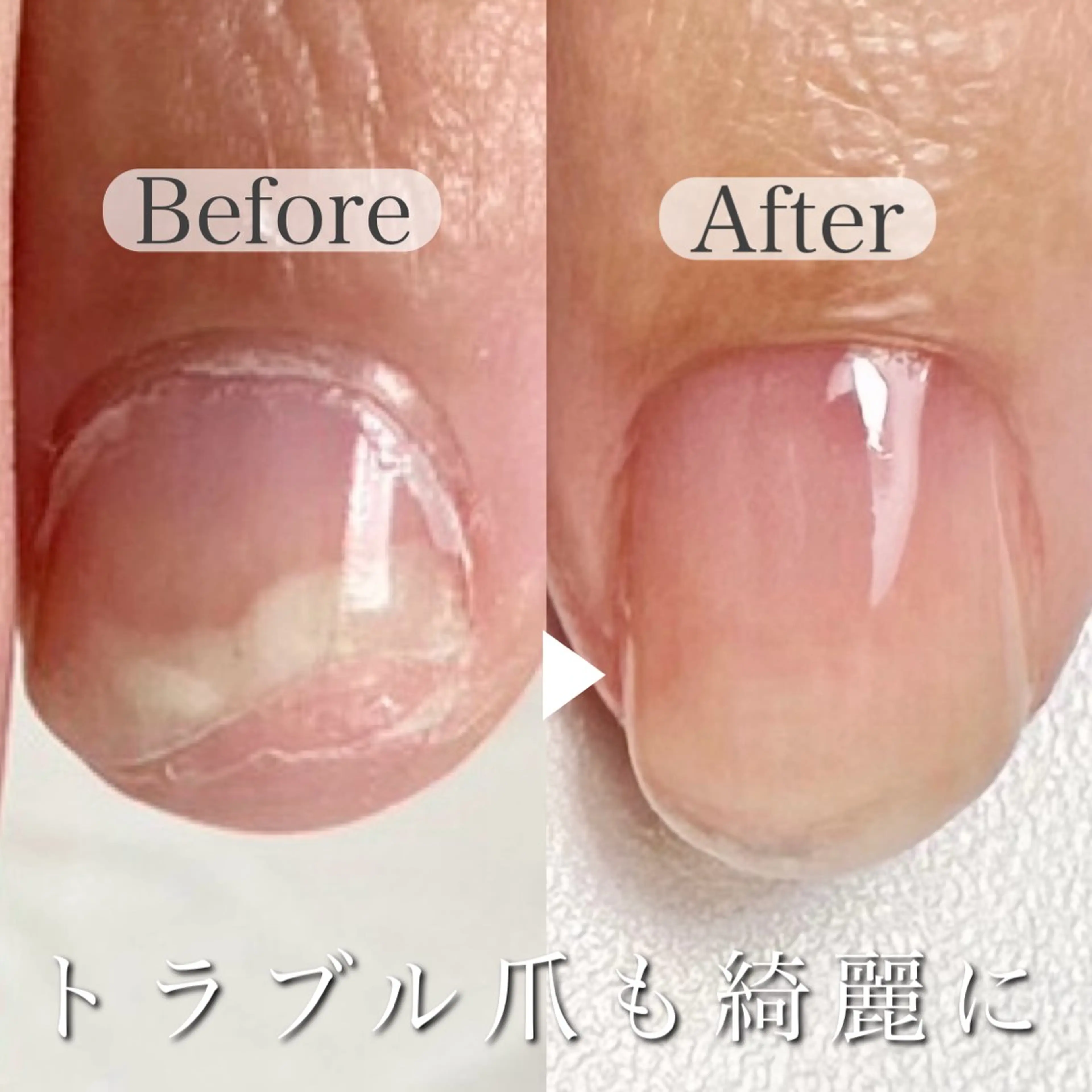 ネイル 深爪専門店 サロンリリーのネイルデザイン