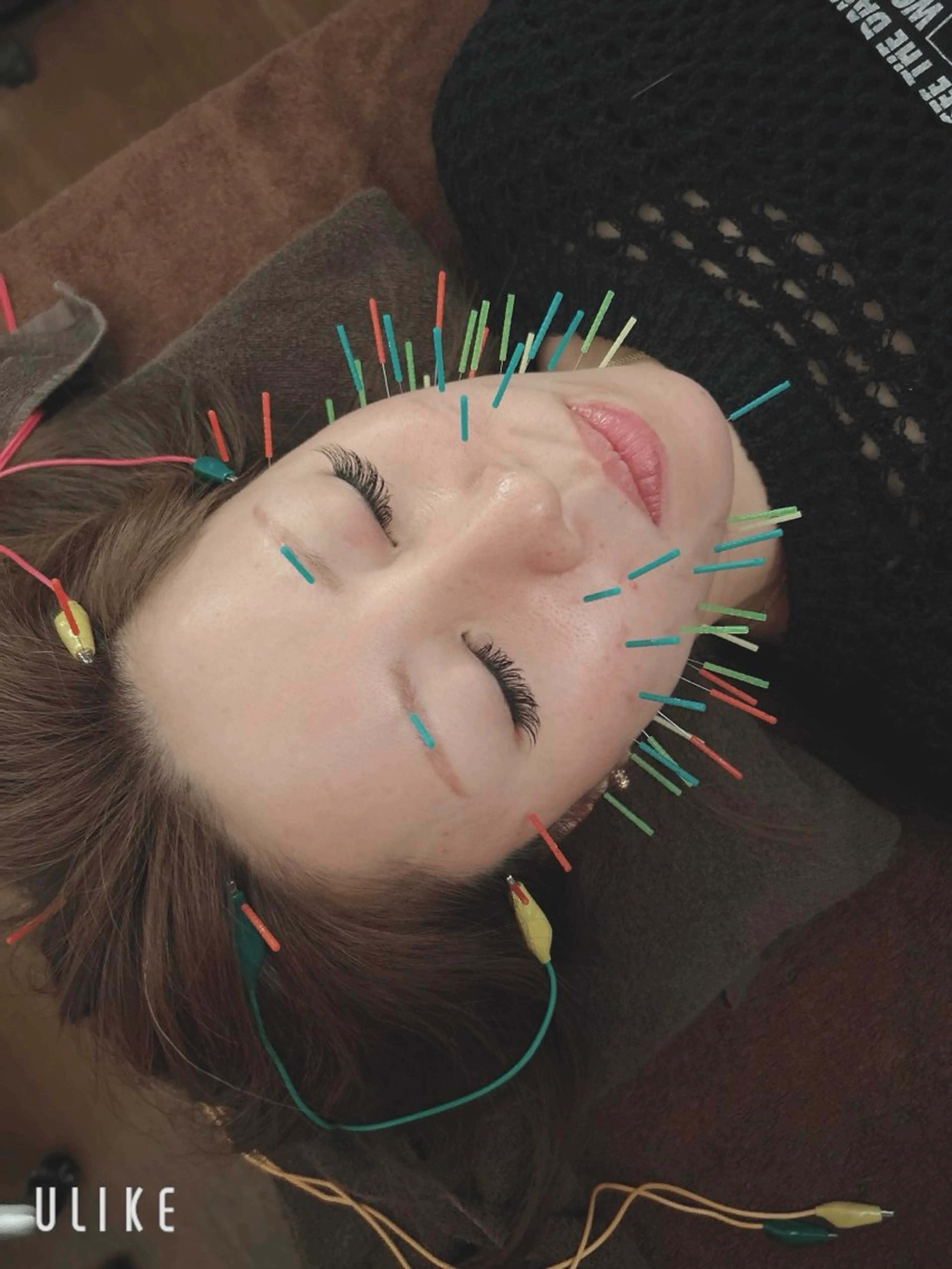 美容鍼灸サロンYOSHINO所属・美容鍼灸サロン YOSHINOのエステ・リラクイメージ