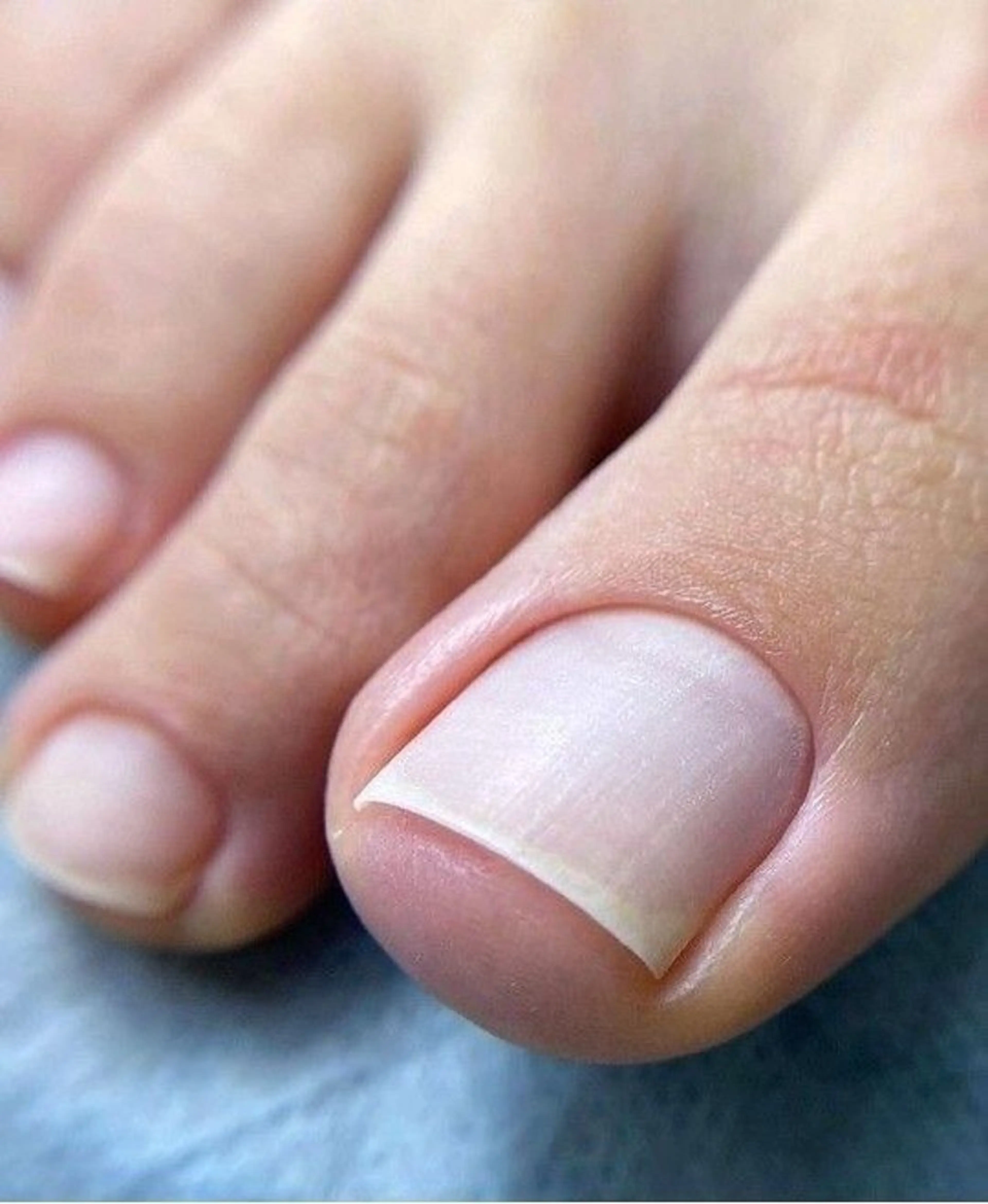 【メンズ限定☆ご新規様】フット・深爪矯正クリア(他店オフ有り・ケア込・長さ無し)の写真