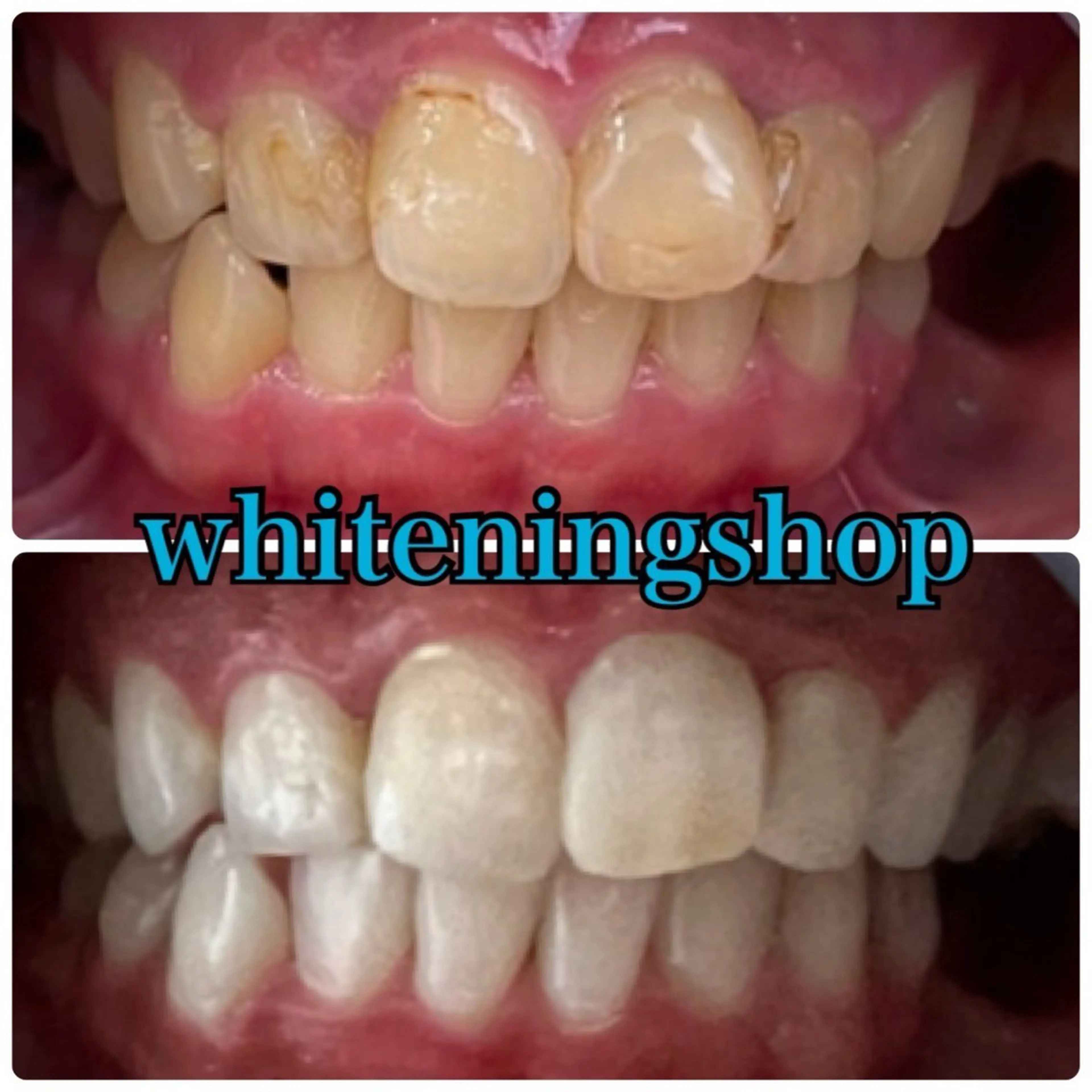 メンズ エステ リラク ホワイトニング ショップ川越店のエステ・リラクイメージ