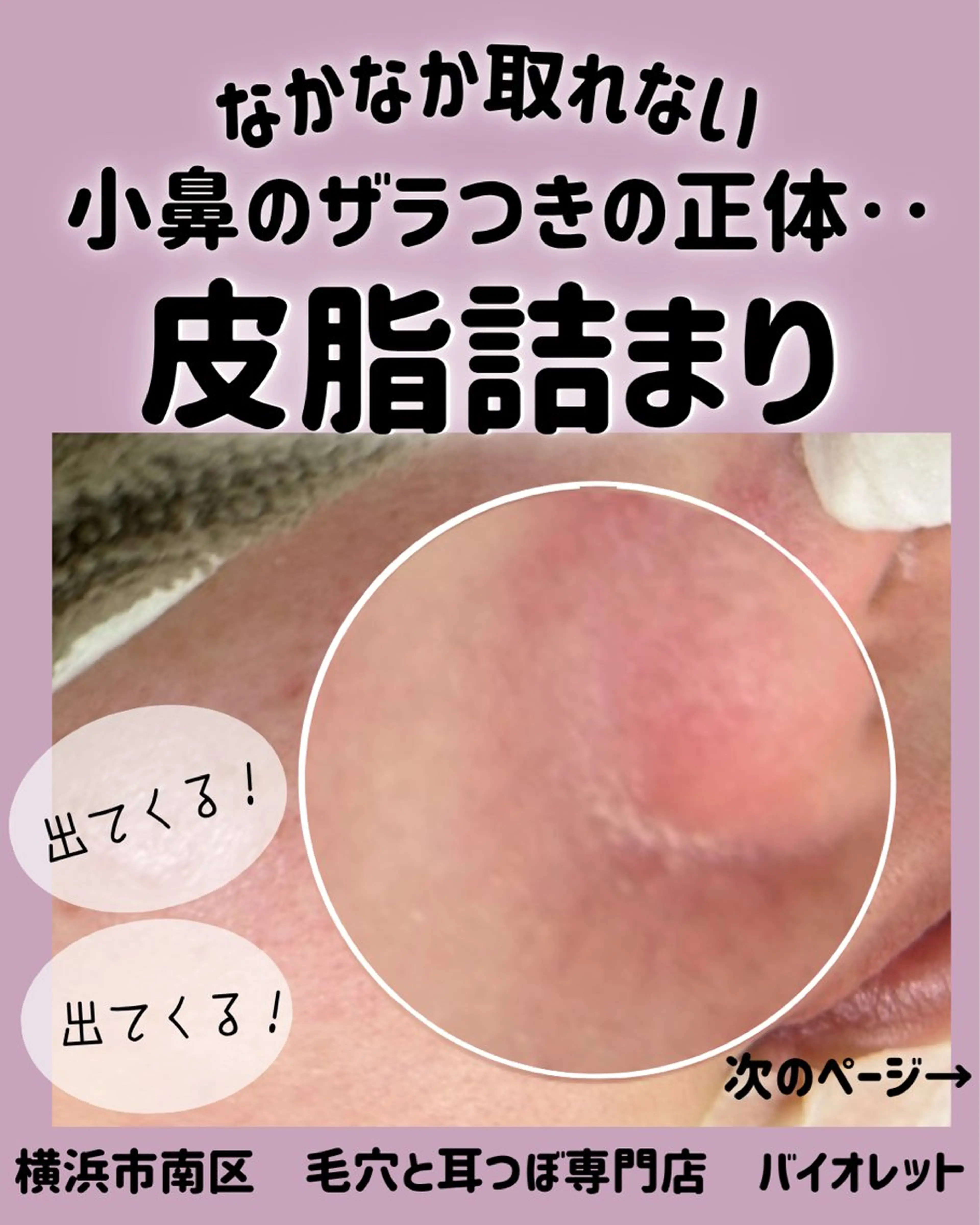 その他 毛穴と耳つぼ専門店 バイオレット　りののその他イメージ