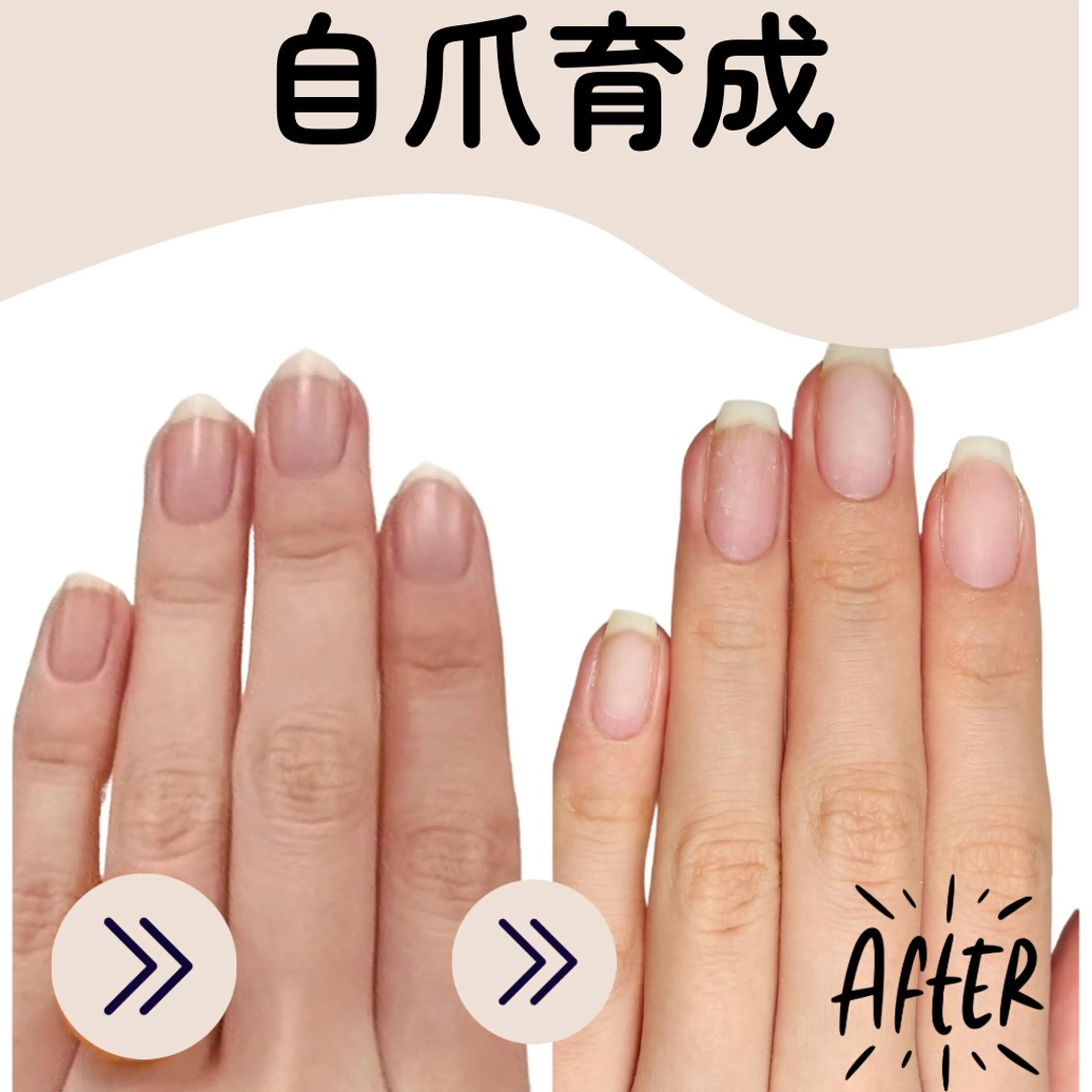 必ず縦長爪をお約束の自爪育成！モニター募集中！（オフ無し）の写真