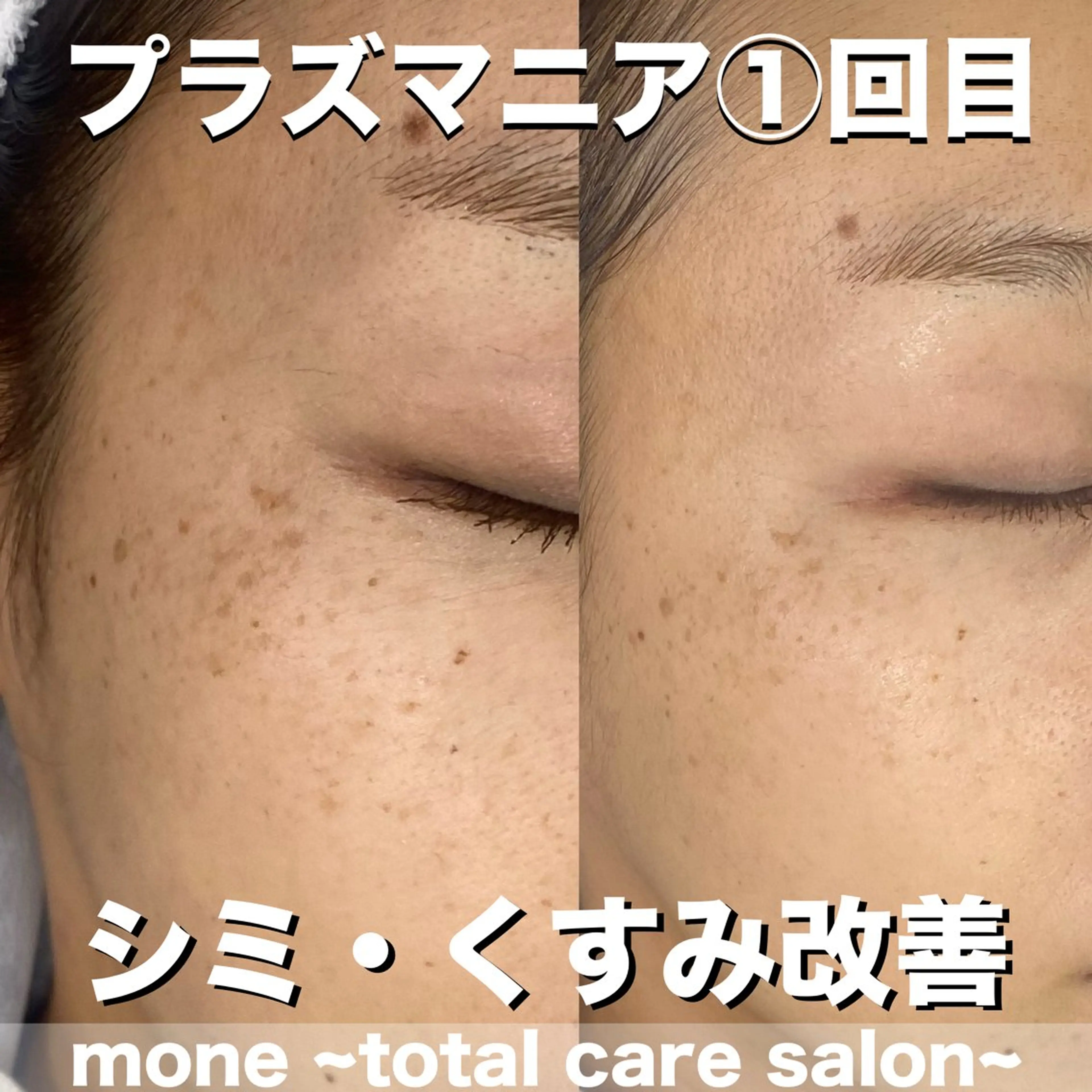 エステ mone~total care salon~所属・mone (モーネ)のエステ・リラクイメージ