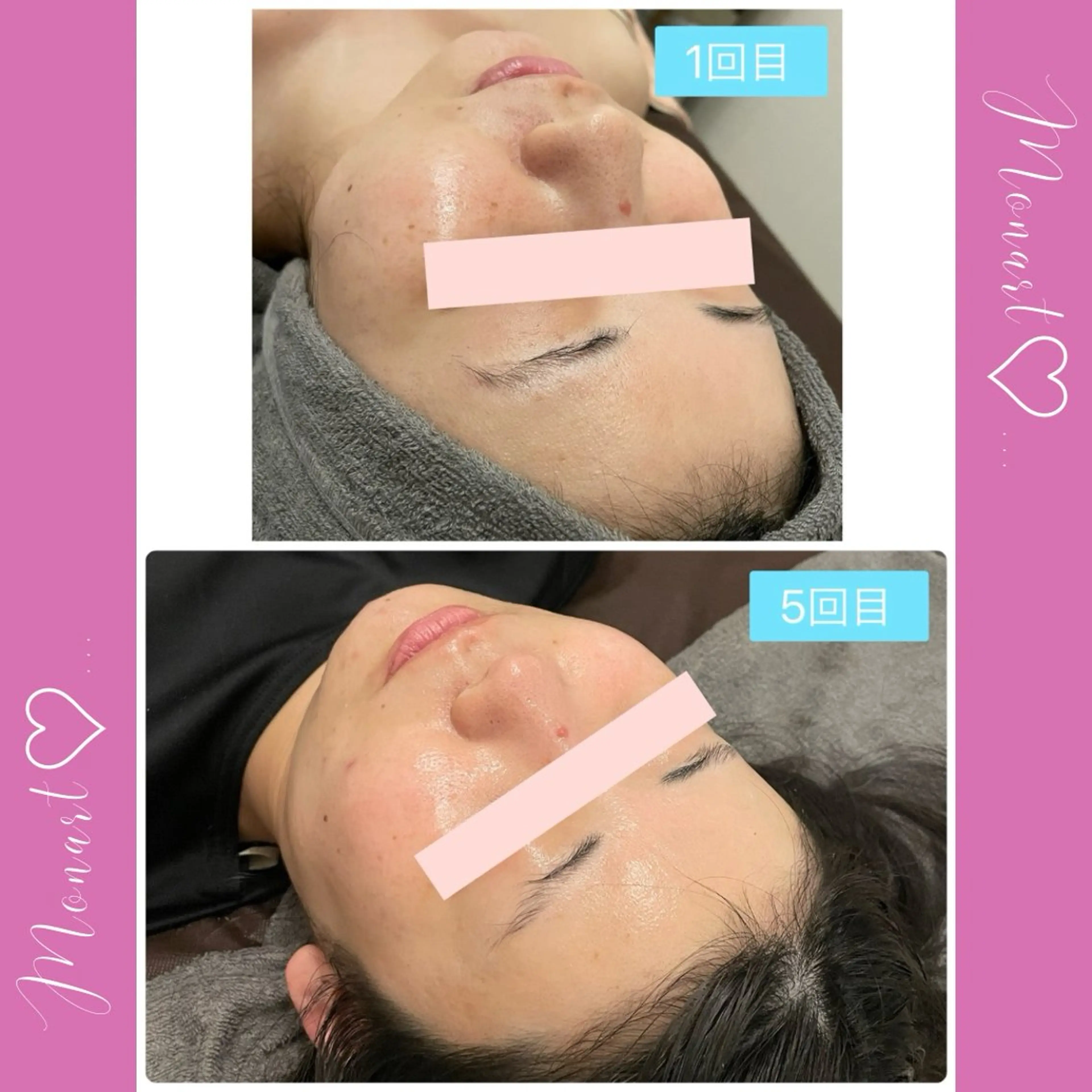 Monart -deux-のエステ・リラクイメージ