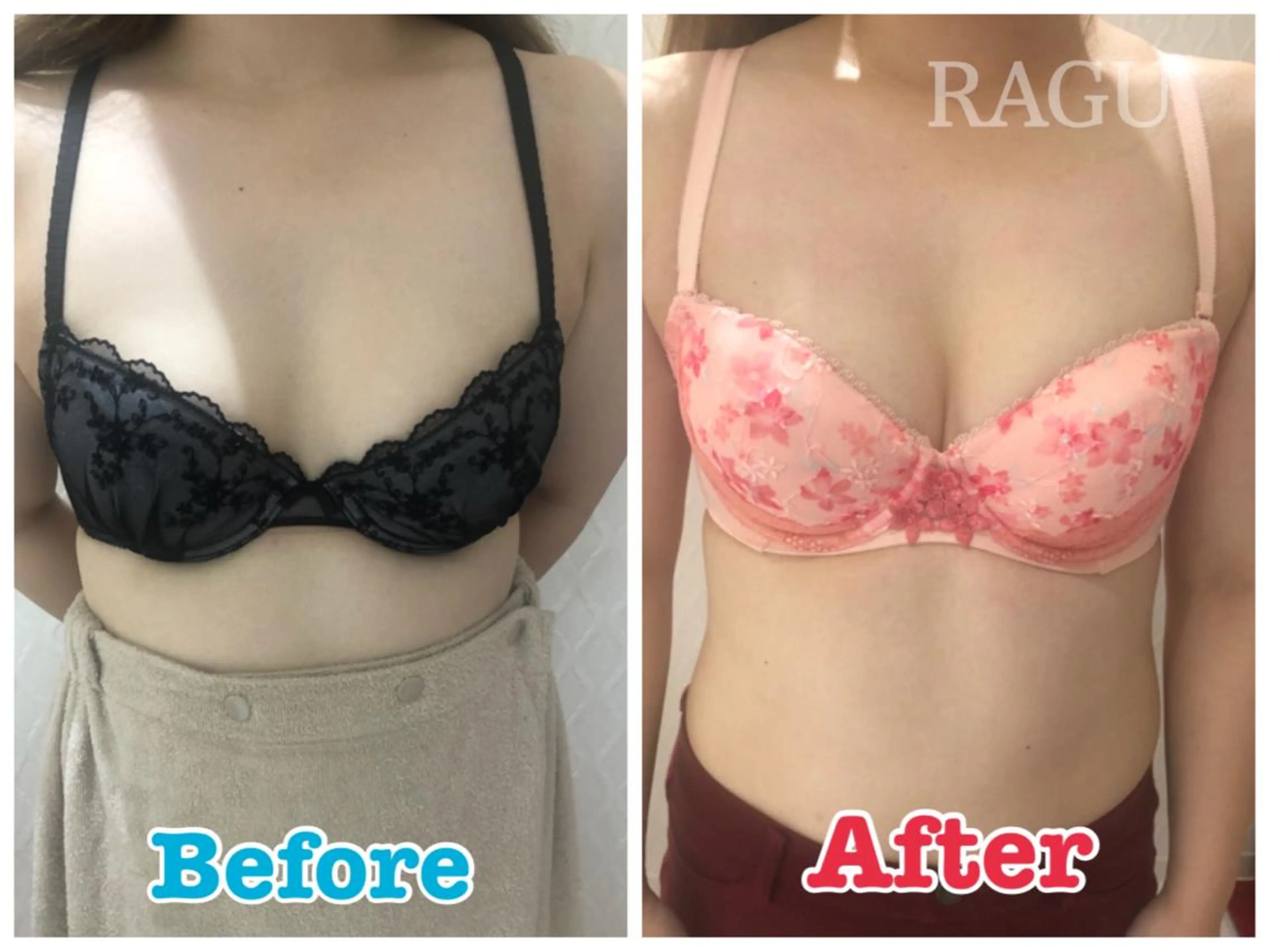 バストアップ（初回）の写真