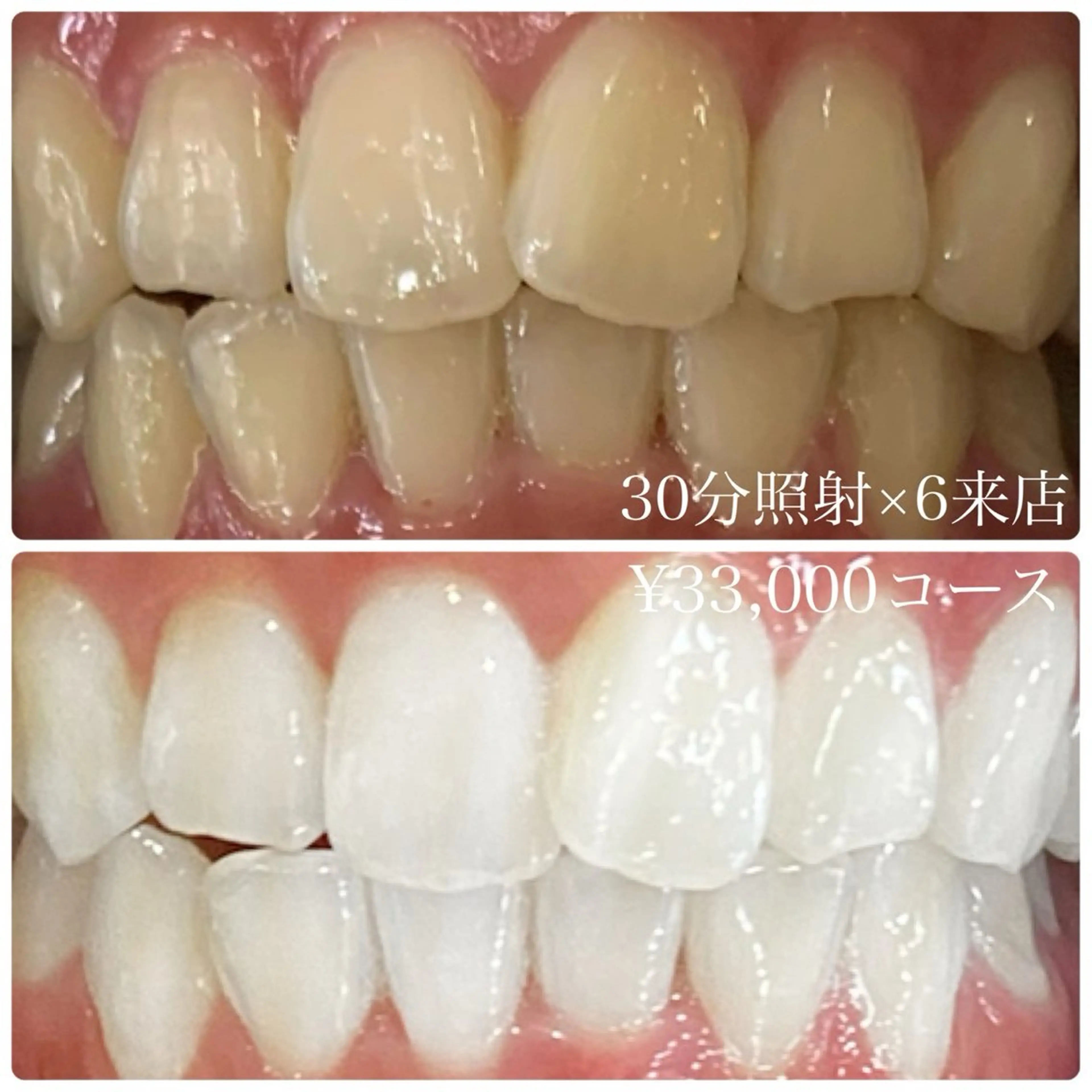 ホワイトニングルーム 横浜店のその他イメージ