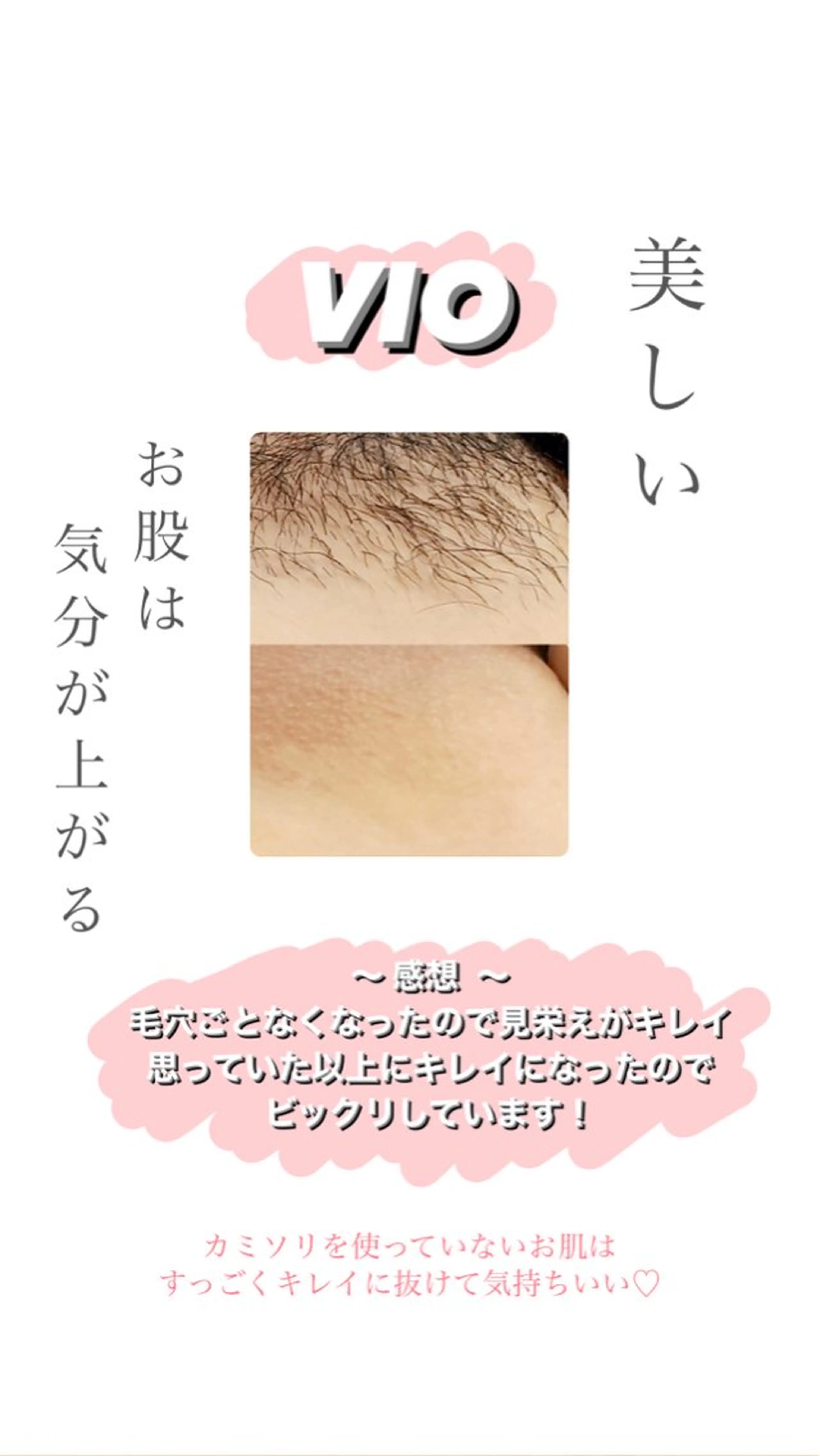 Hitomi シュガーリング豊橋のその他イメージ