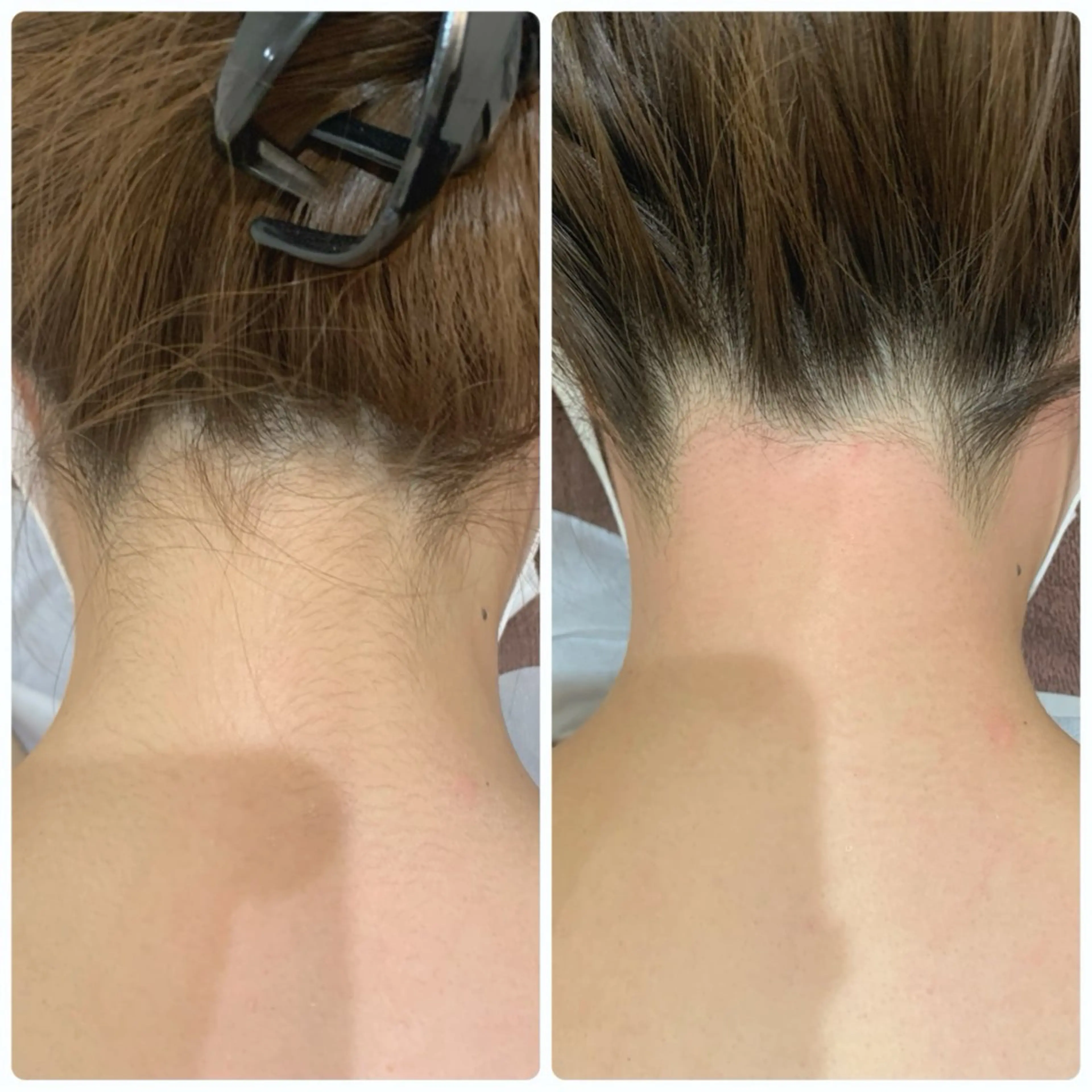 脱毛 M’s Beauty所属・M's Beautyのエステ・リラクイメージ