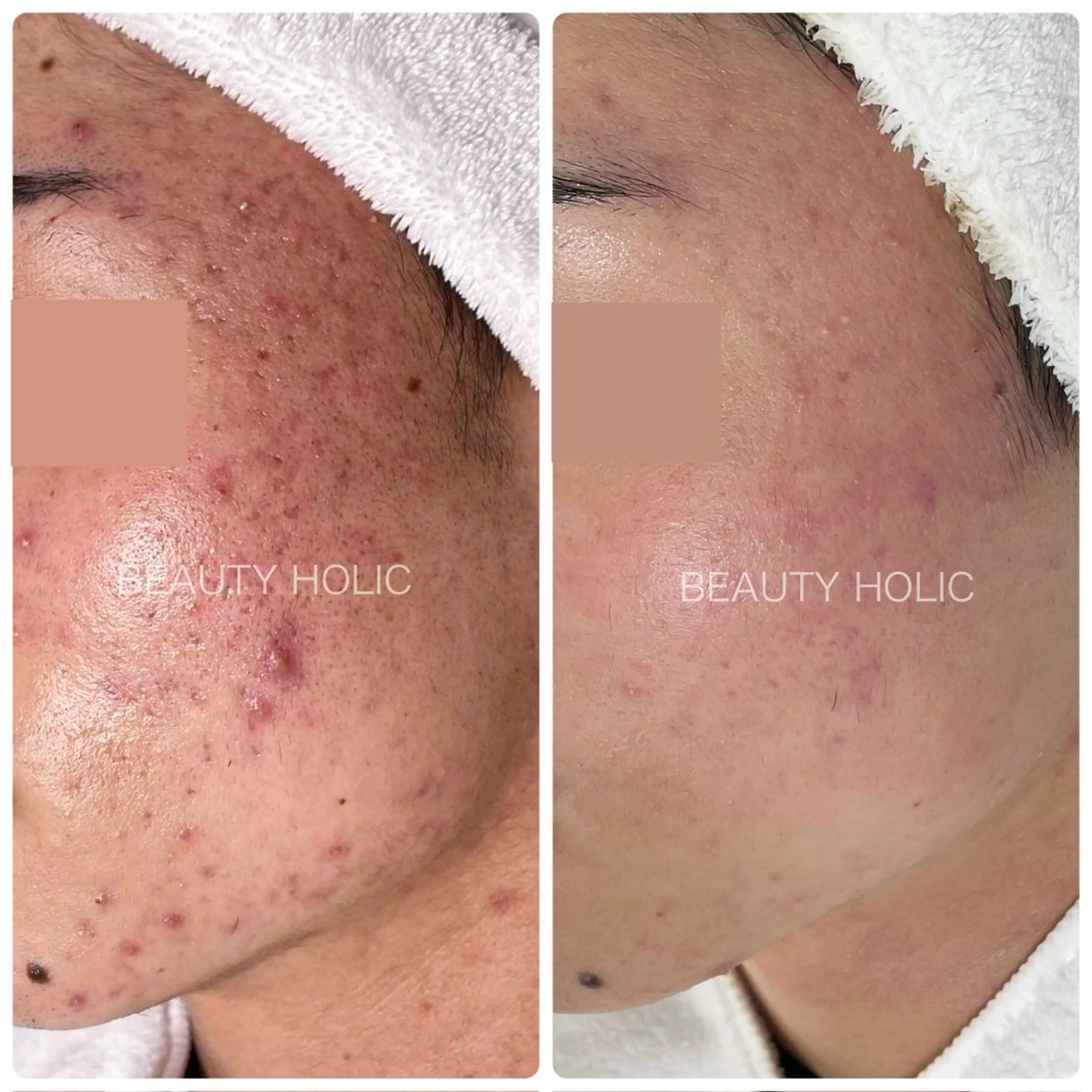 ビューティーホリック 東金店のエステ・リラクイメージ