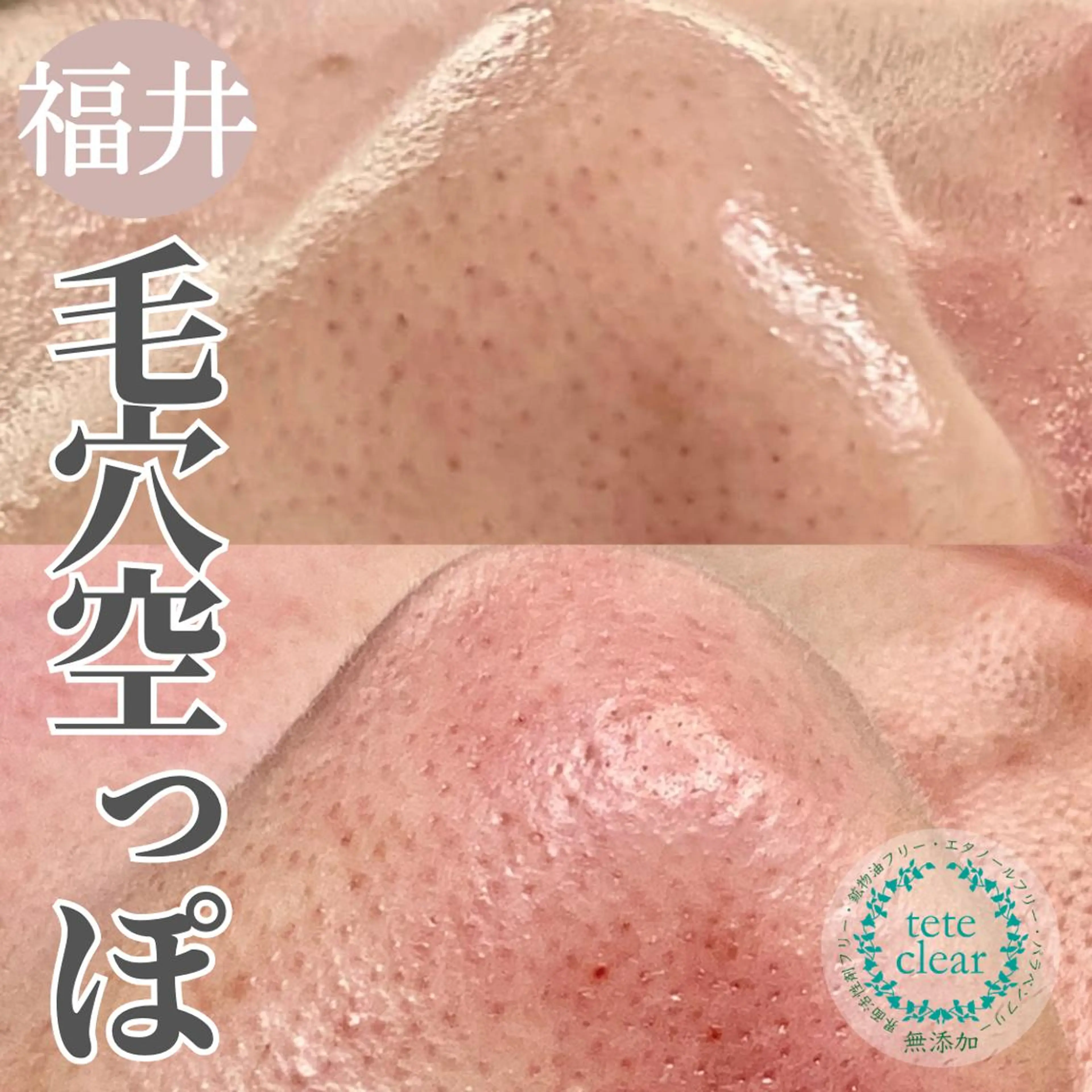 毛穴肌質ケアサロン Yourmeユアミーのエステ・リラクイメージ