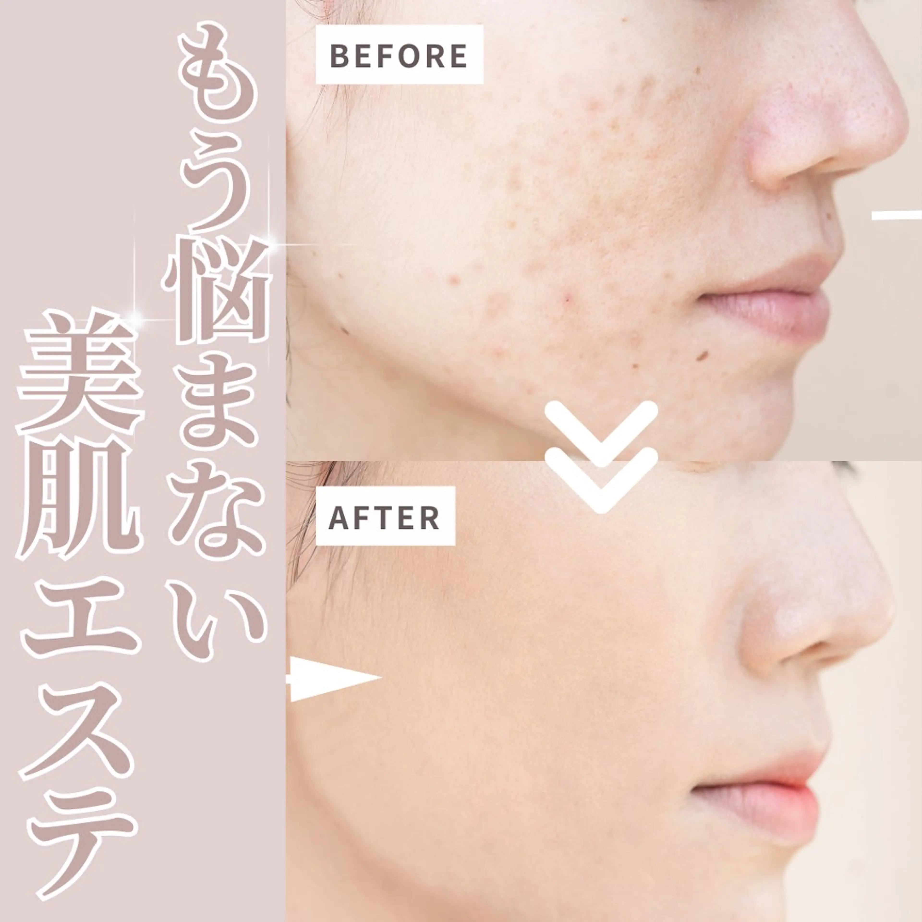 アイアンド ネイルデイのエステ・リラクイメージ