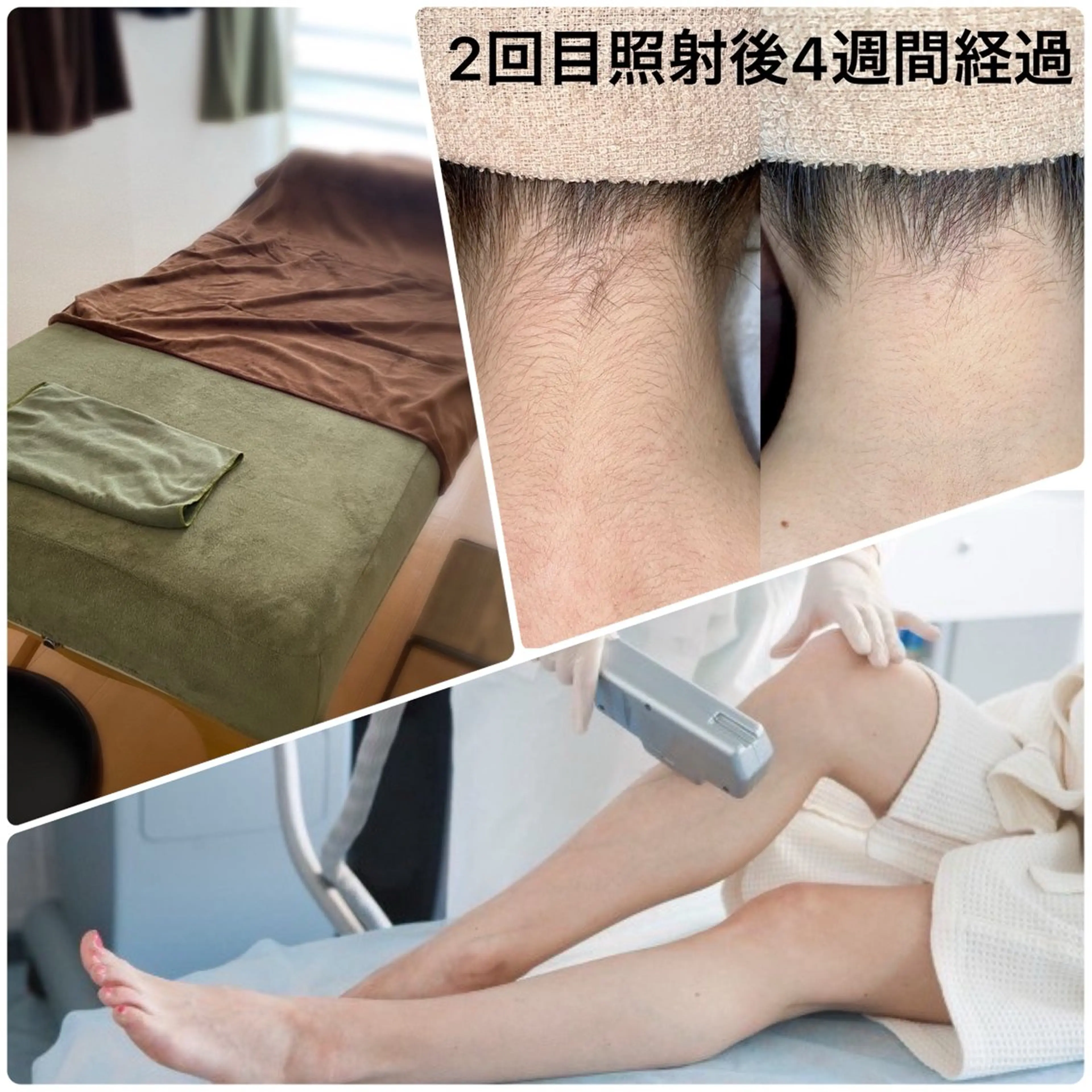 脱毛 . ひふみのエステ・リラクイメージ