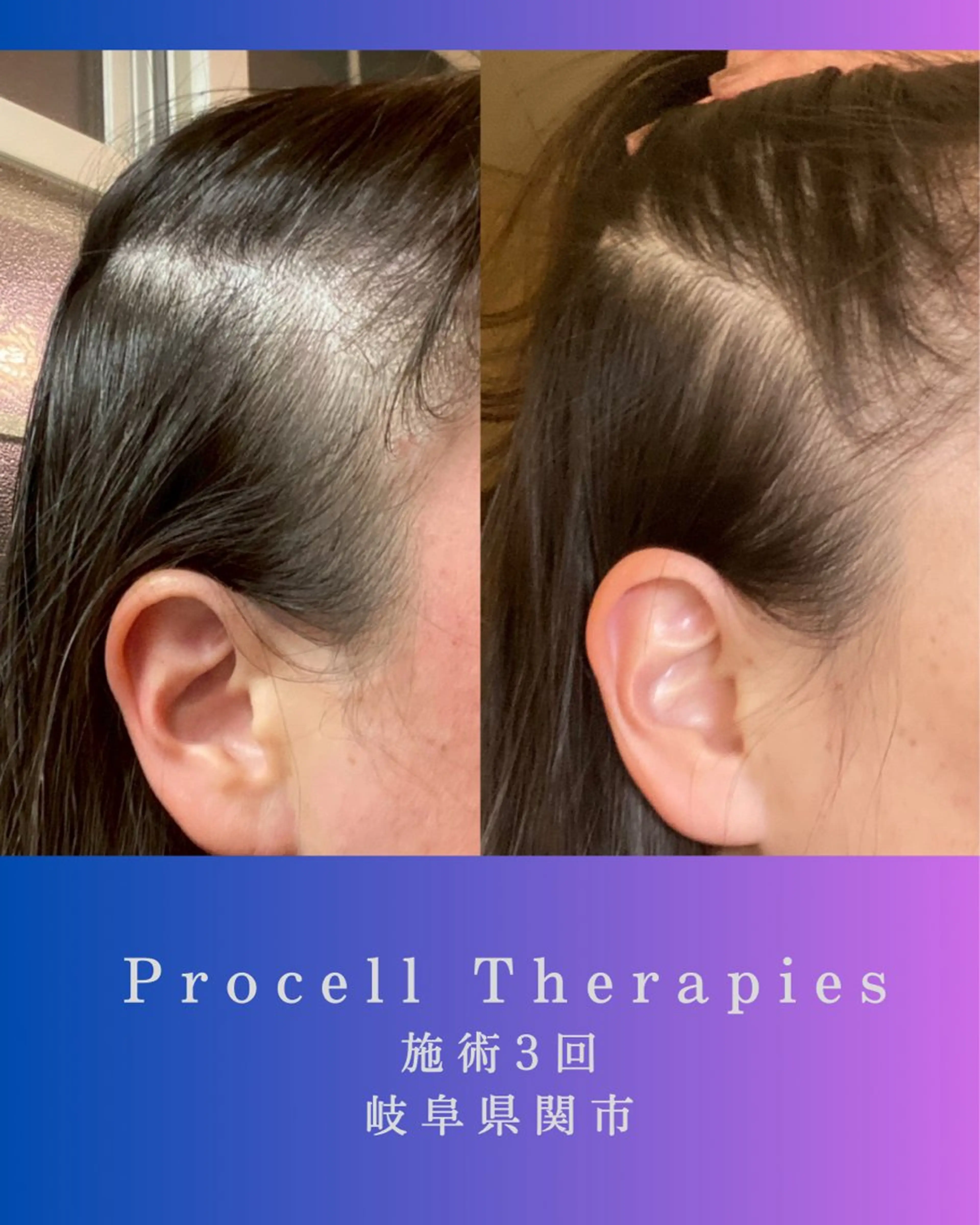 その他 氣楽所属・松下 さゆりのエステ・リラクイメージ